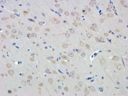 Immunohistochemical staining of rat brain tissue using LOX-1 antibody (dilution of primary antibody - 1:100)