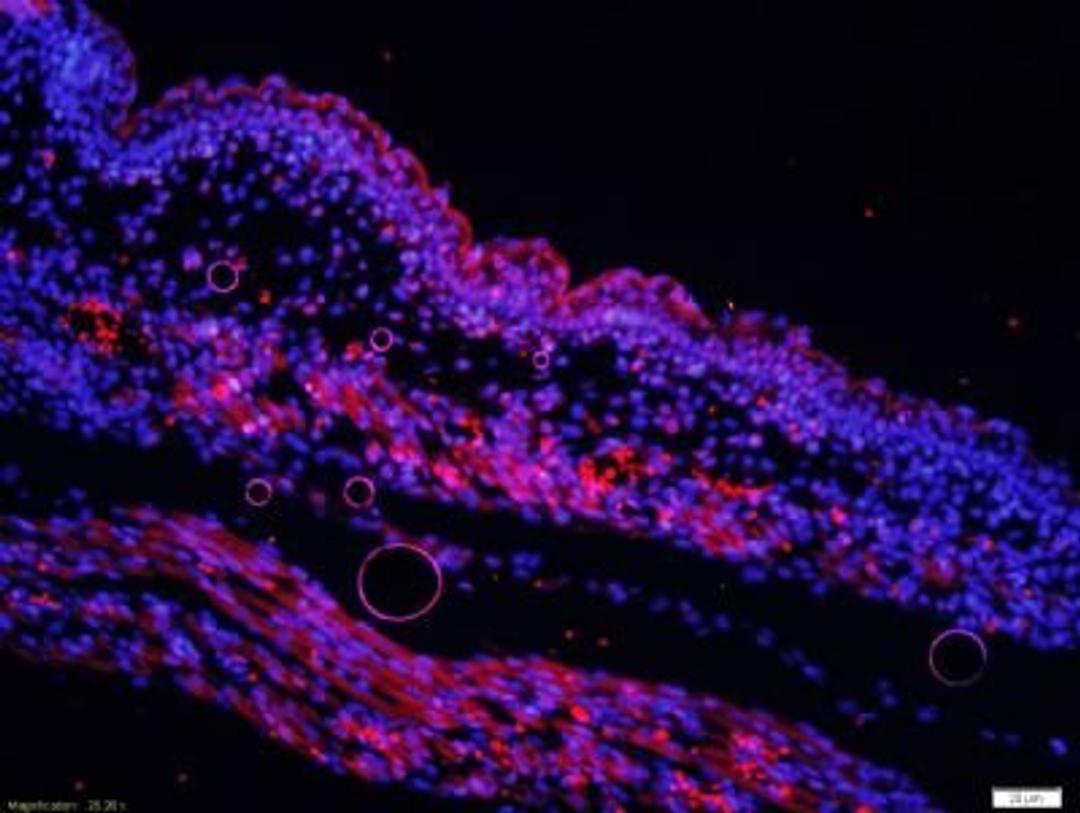 Immunohistochemical analysis of formalin-fixed paraffin embedded Mouse embryos tissue using ADAM12 antibody (dilution at 1:200)