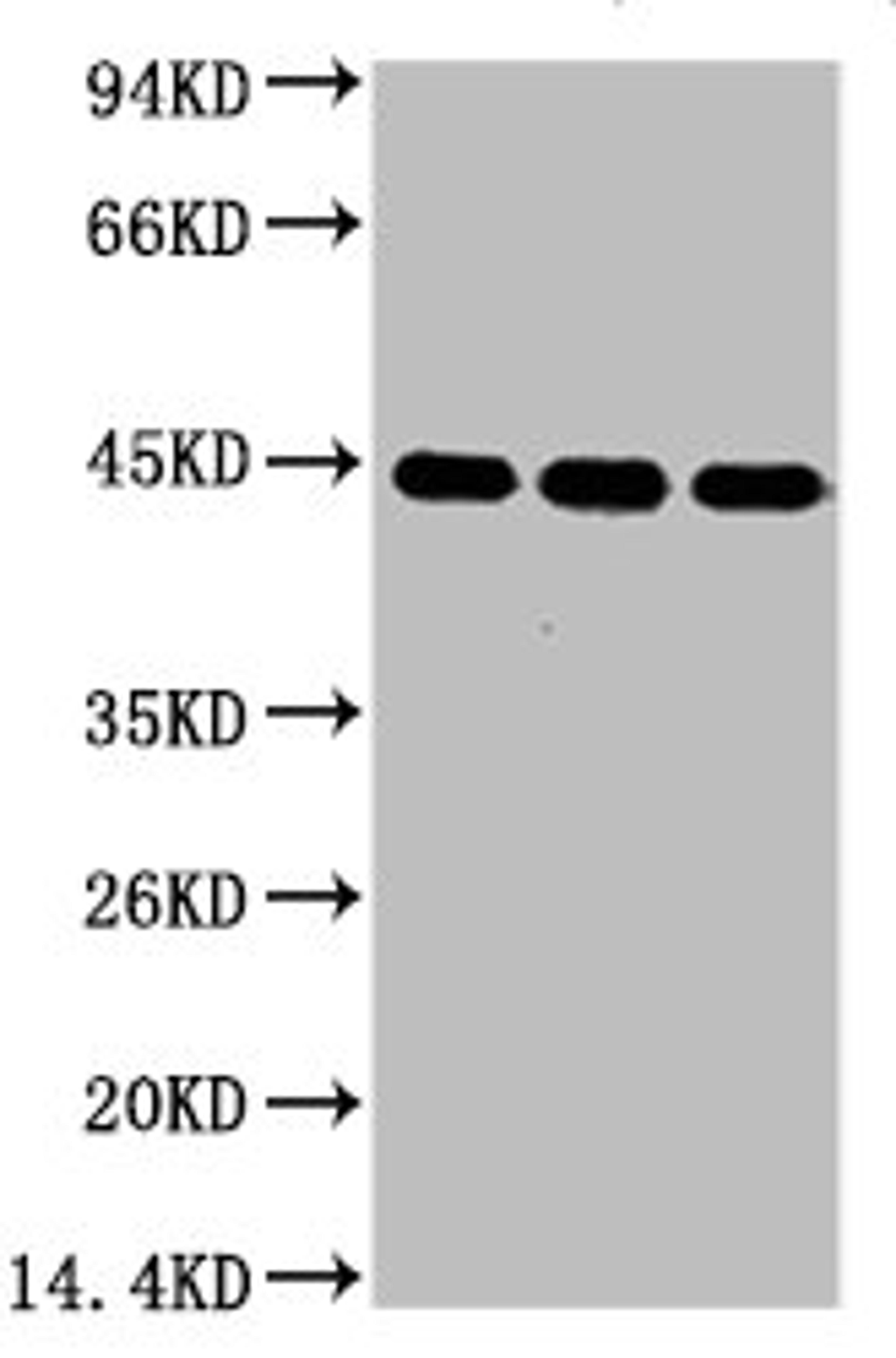 Western blot analysis of 1) Hela, 2) Mouse Brain tissue, 3) Rat Brain tissue, diluted at 1:5000.