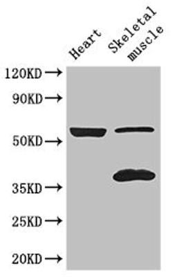 Western Blot. Positive WB detected in: Mouse heart tissue, Mouse skeletal muscle tissue. All lanes: IQCG antibody at 3.4ug/ml. Secondary. Goat polyclonal to rabbit IgG at 1/50000 dilution. Predicted band size: 52, 41 kDa. Observed band size: 52, 4 kDa. 
