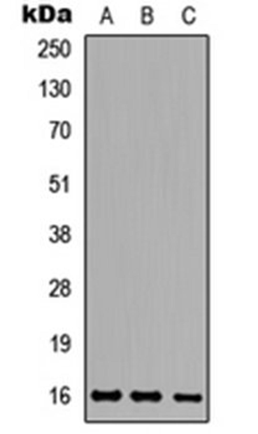 Western blot analysis of HeLa (Lane 1), Raw264.7 (Lane 2), H9C2 (Lane 3) whole cell lysates using Ataxin 7L1 antibody