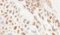 Detection of human JMJD1C by immunohistochemistry.