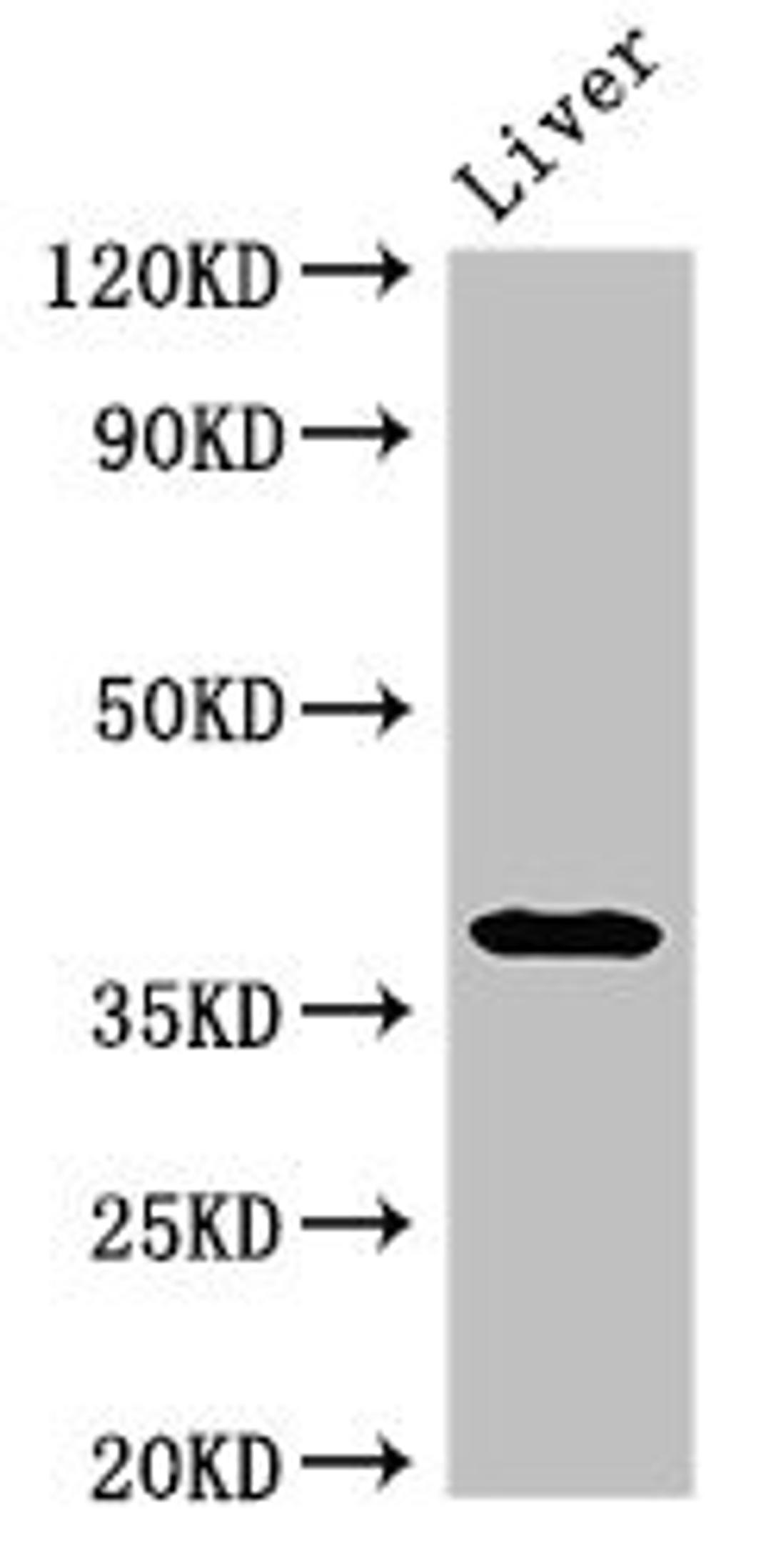 Western Blot. Positive WB detected in: Rat liver tissue. All lanes: PRKAG1 antibody at 3ug/ml. Secondary. Goat polyclonal to rabbit IgG at 1/50000 dilution. Predicted band size: 38, 35, 39 kDa. Observed band size: 38 kDa. 