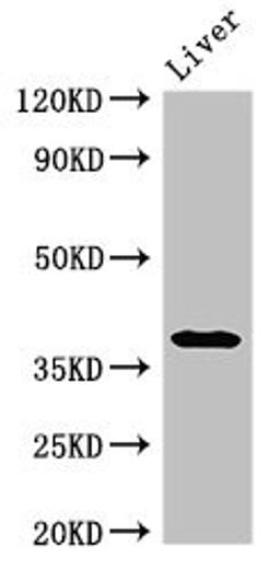Western Blot. Positive WB detected in: Rat liver tissue. All lanes: PRKAG1 antibody at 3ug/ml. Secondary. Goat polyclonal to rabbit IgG at 1/50000 dilution. Predicted band size: 38, 35, 39 kDa. Observed band size: 38 kDa. 