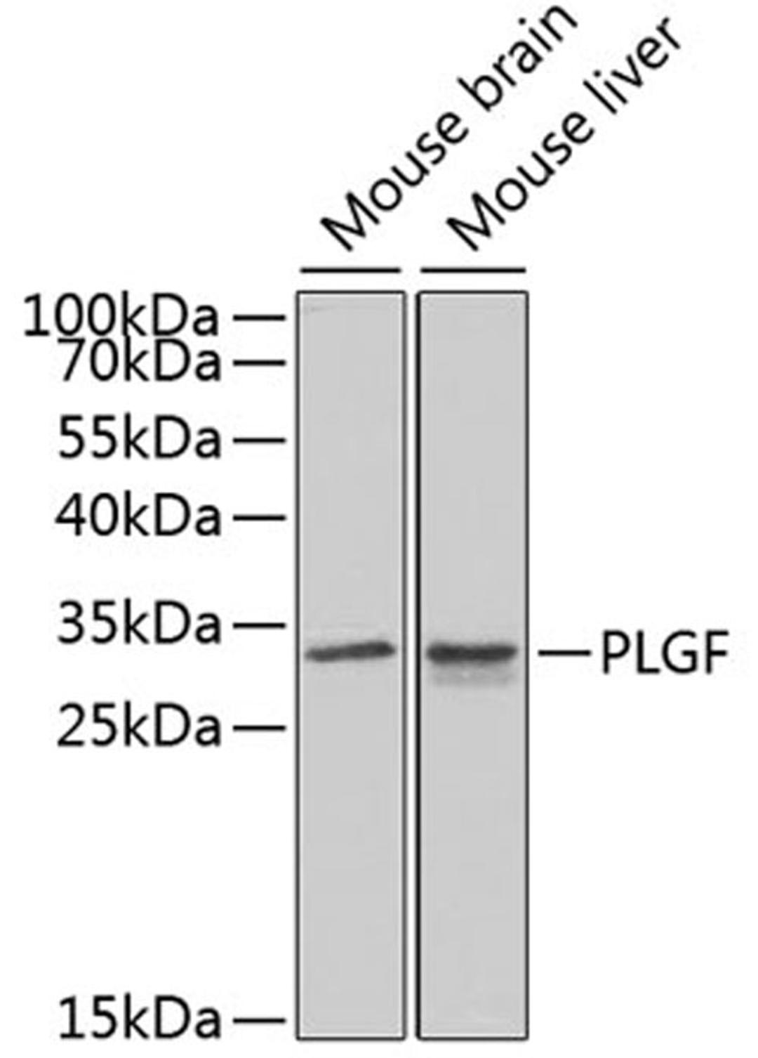 Western blot - PLGF antibody (A1727)