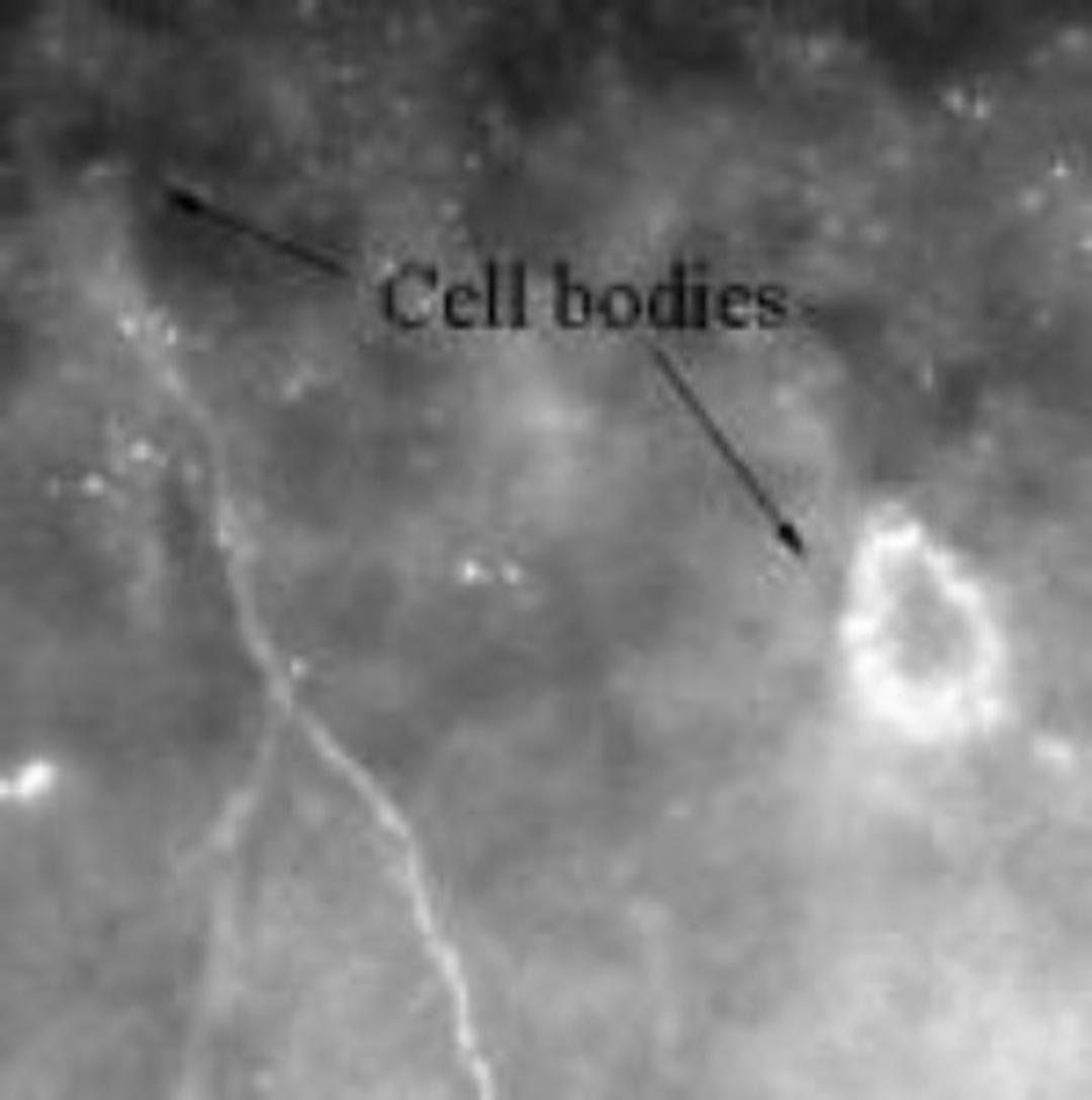 Immunocytochemistry/Immunofluorescence: CaMKII beta Antibody [NB120-22131] - Staining of CAMKIIb using NB120-22131 in rat hippocampal neurons at a dilution of 1:100, note that staining is rather weak.