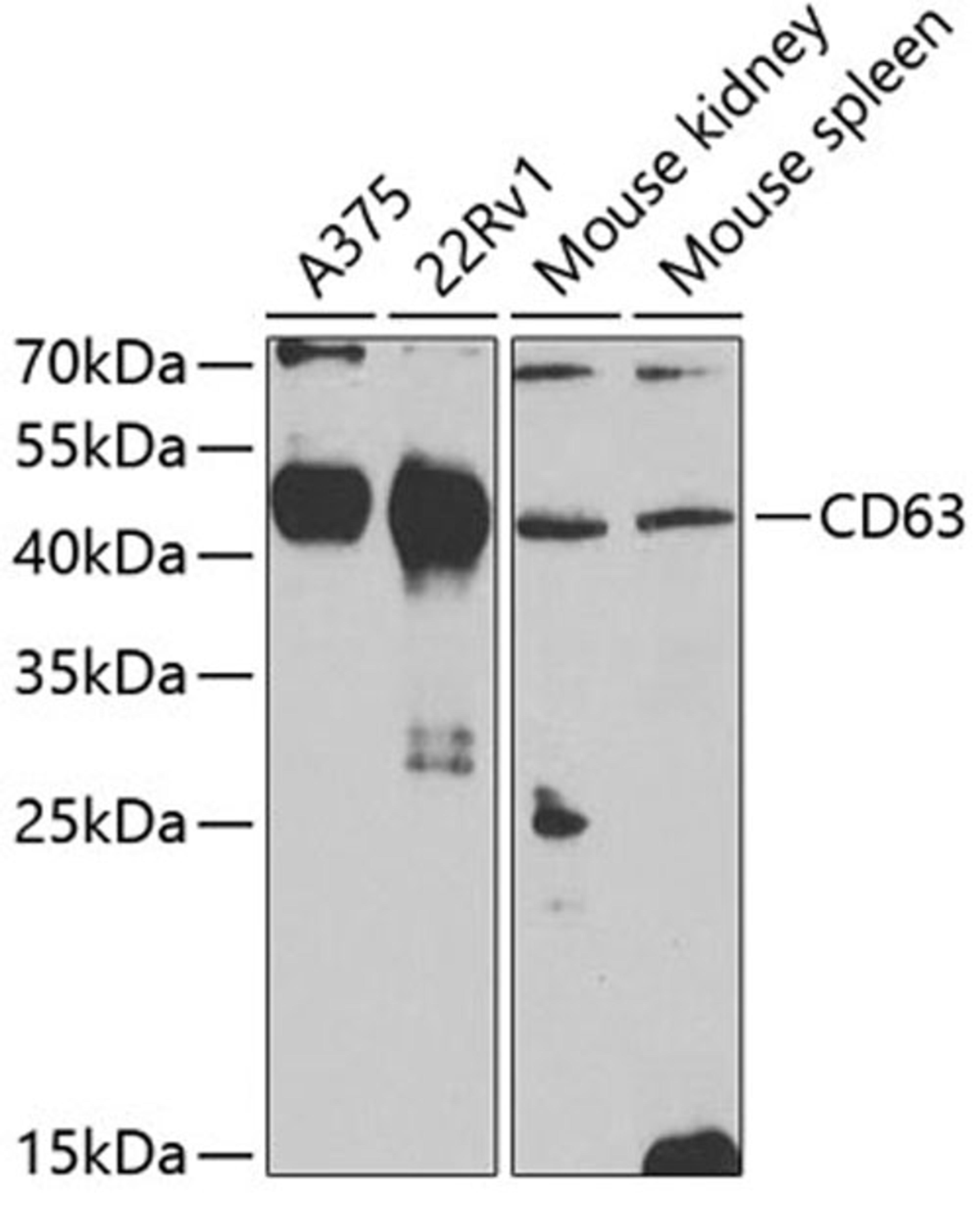 Western blot - CD63 Antibody (A5271)