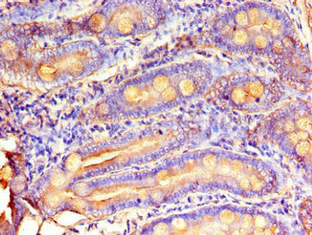 Immunohistochemistry of paraffin-embedded human small intestine tissue using CSB-PA015209LA01HU at dilution of 1:100