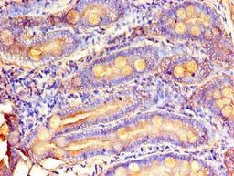 Immunohistochemistry of paraffin-embedded human small intestine tissue using CSB-PA015209LA01HU at dilution of 1:100