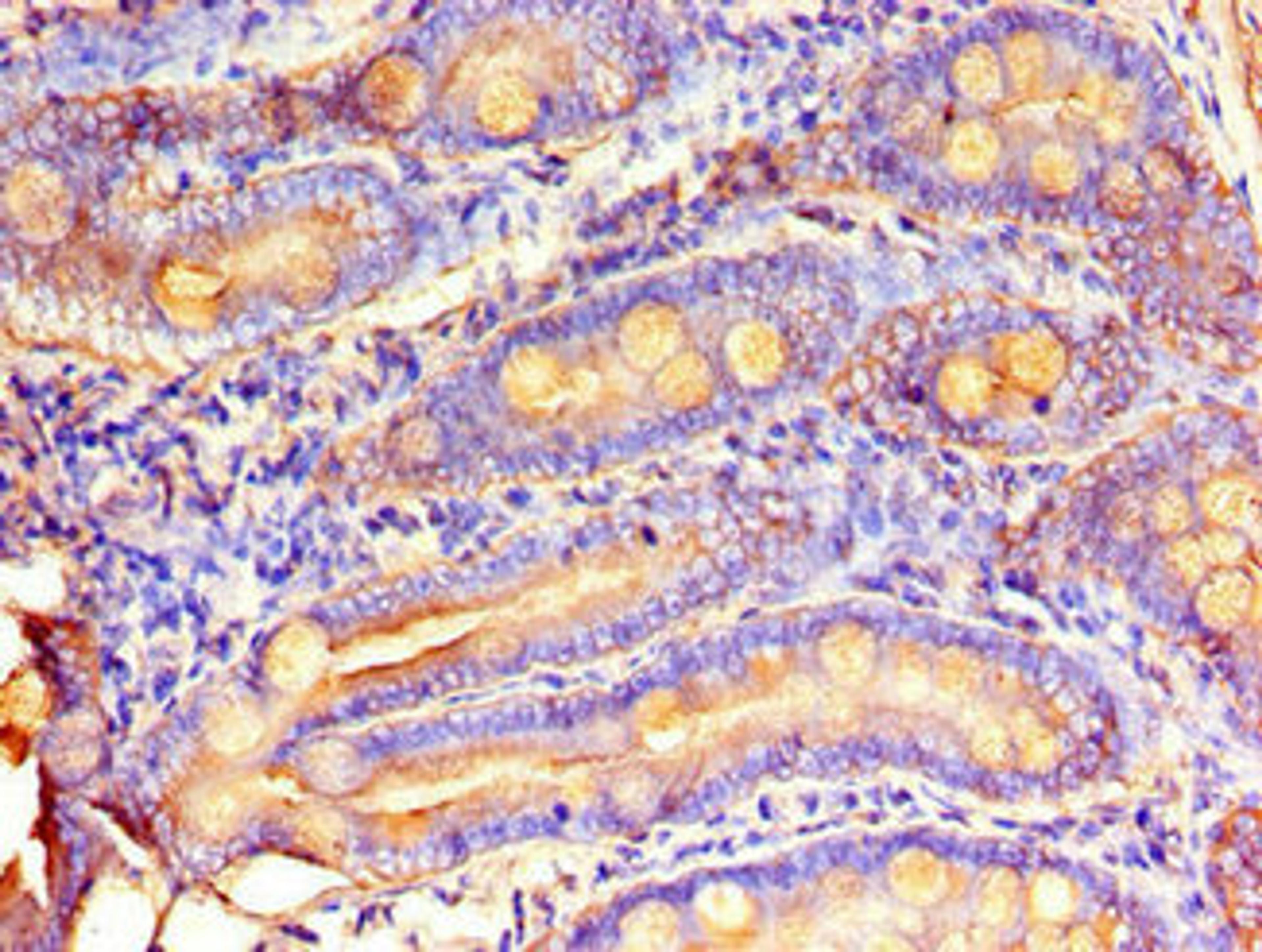 Immunohistochemistry of paraffin-embedded human small intestine tissue using CSB-PA015209LA01HU at dilution of 1:100