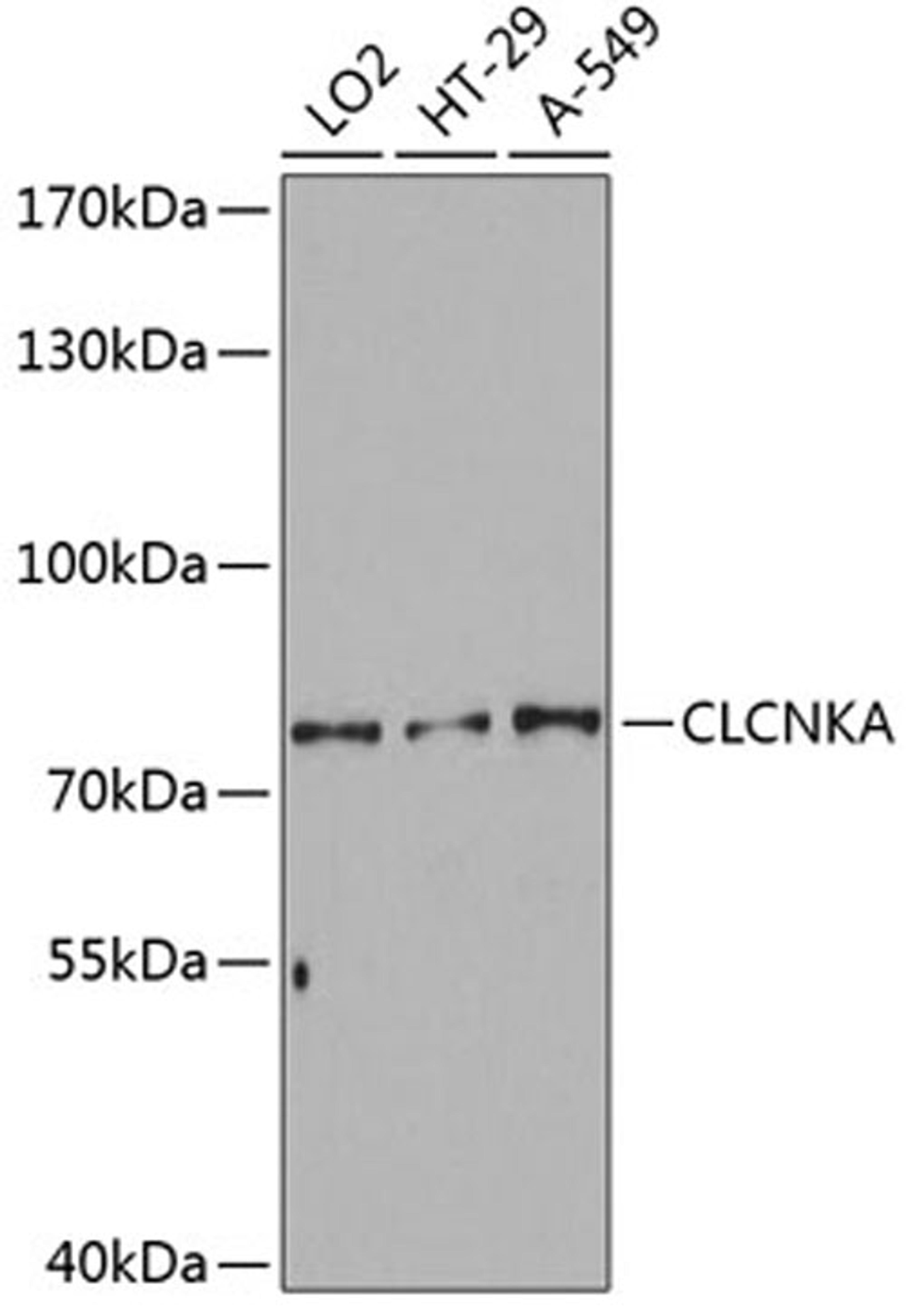 Western blot - CLCNKA Antibody (A3792)