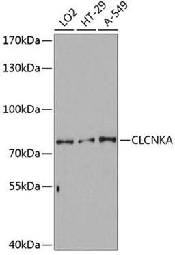 Western blot - CLCNKA Antibody (A3792)