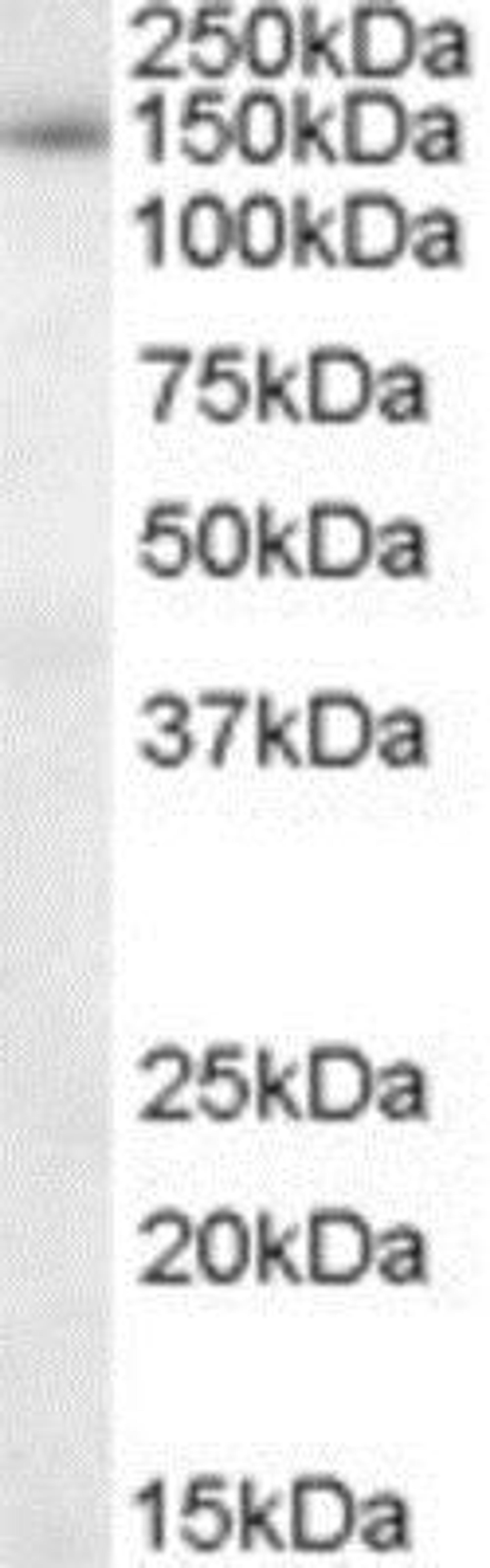 Western Blot: SAP130 Antibody [NB100-1077] - Staining (0.1ug/ml) of nuclear lysate from HeLa cells (RIPA buffer, 30ug total protein per lane). Primary incubated for 1 hour. Detected by western blot using chemiluminescence