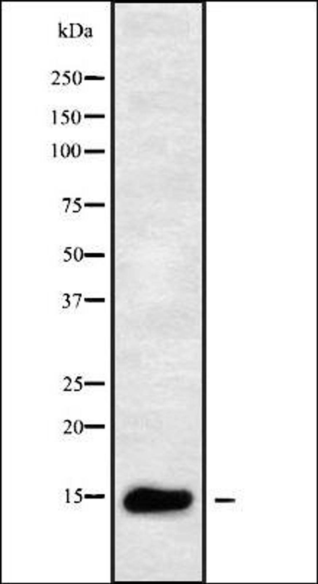 Western blot analysis of K562 whole cell lysates using TCEAL8 antibody