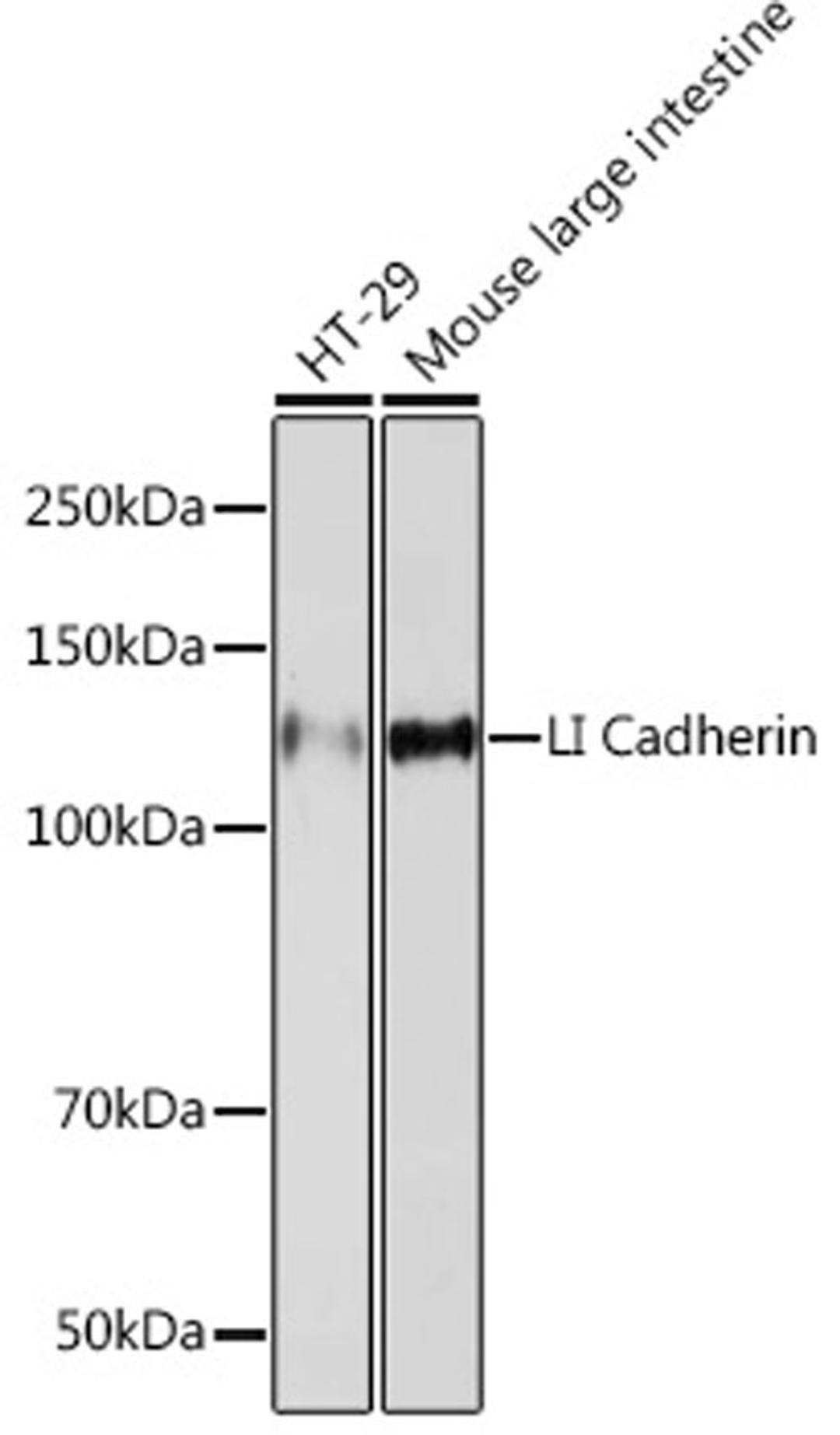 Western blot - LI Cadherin Rabbit mAb (A5286)