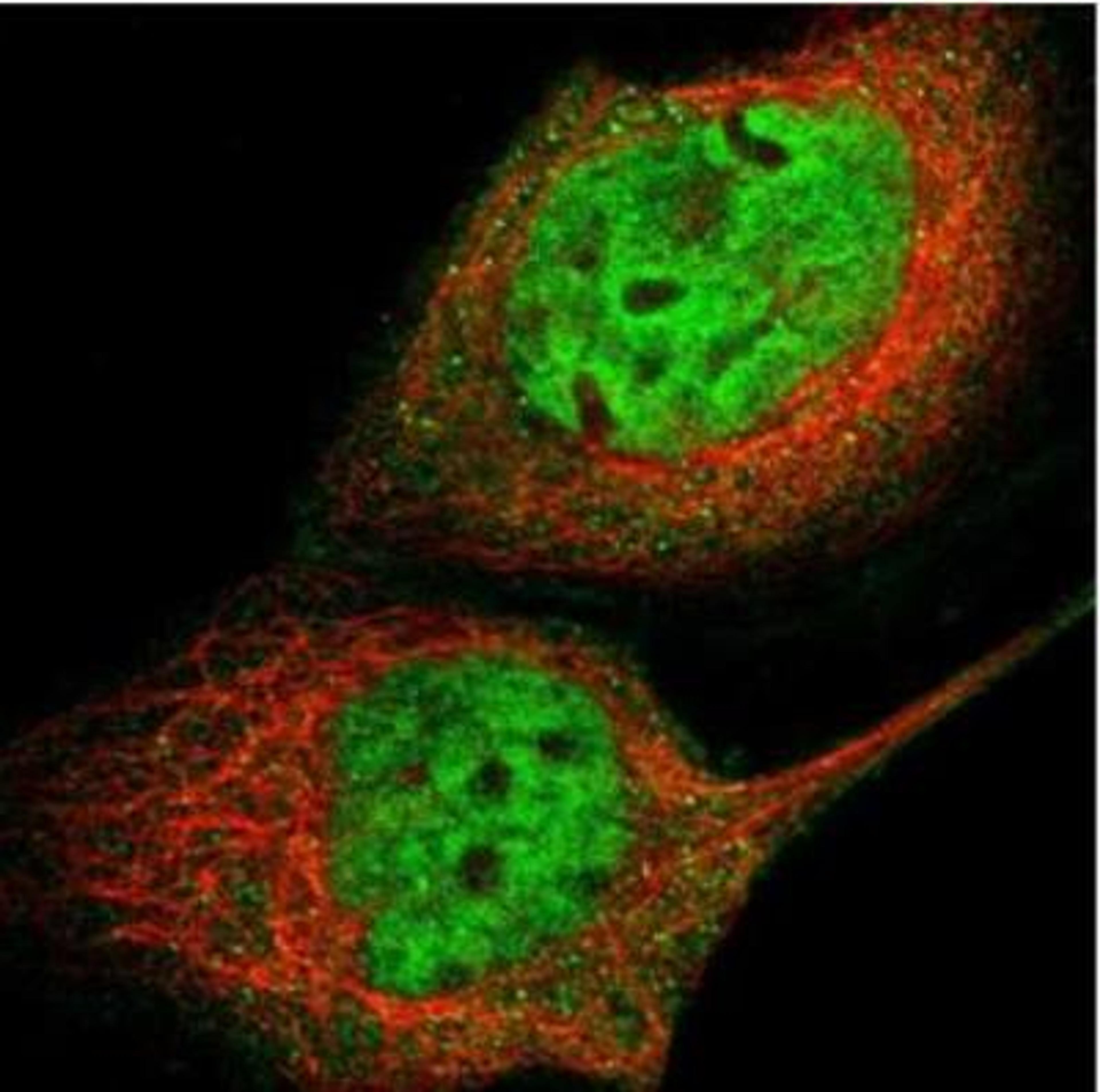 Immunocytochemistry/Immunofluorescence: GCR2 Antibody [NBP2-33278] - Immunofluorescent staining of human cell line A-431 shows positivity in nucleus but not nucleoli & cytoplasm. Antibody staining is shown in green.