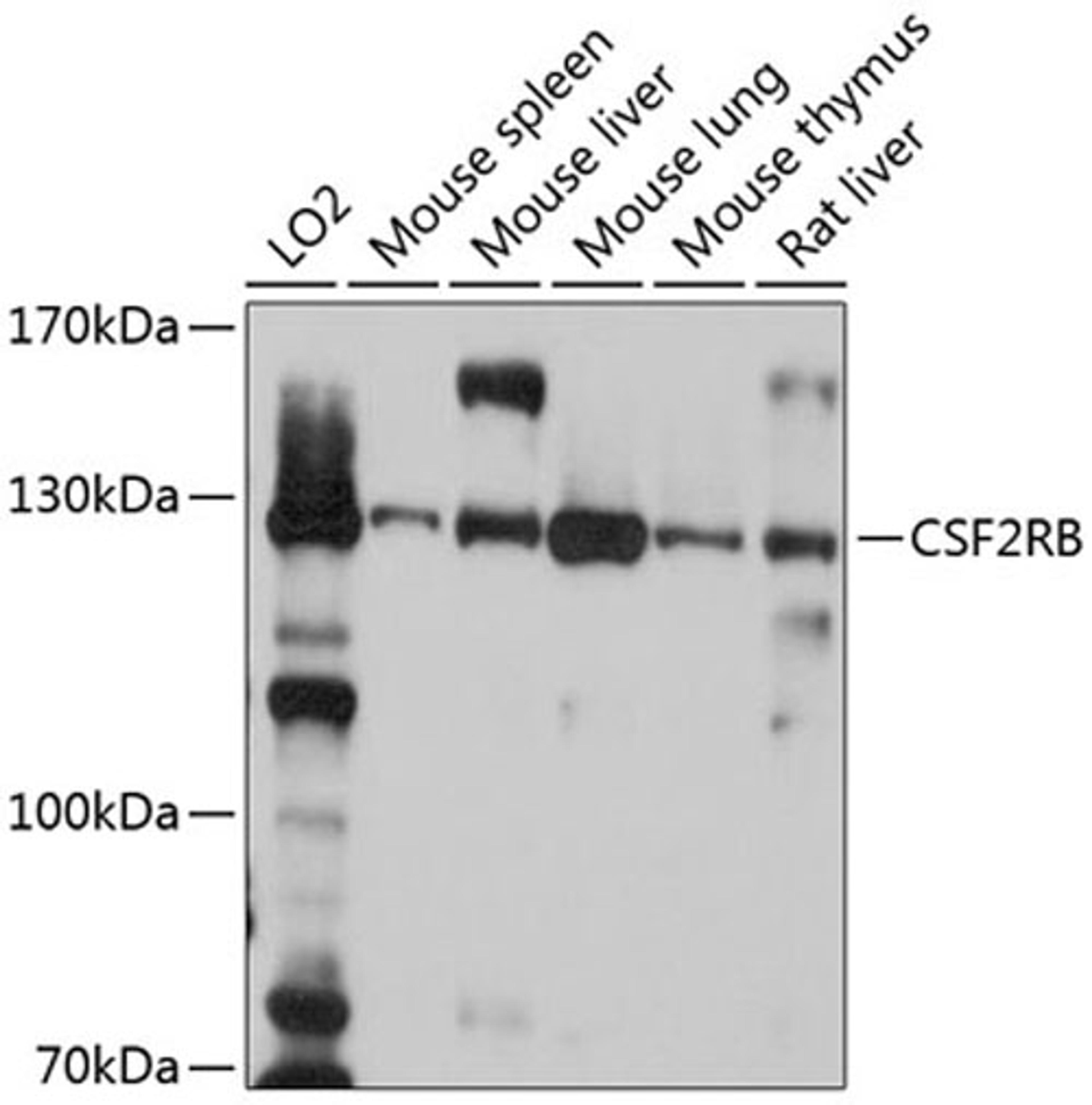 Western blot - CSF2RB antibody (A10501)