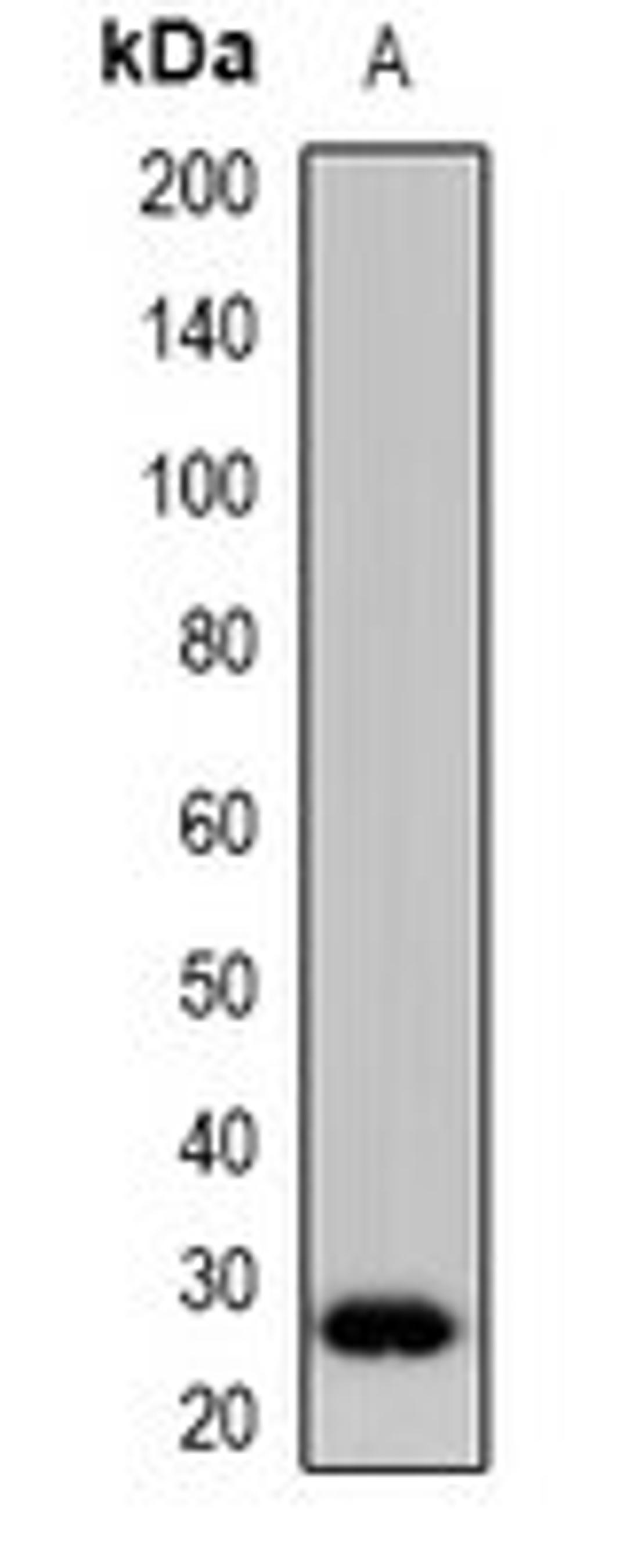 Western blot analysis of HepG2 (Lane1) whole cell lysates using CLEC4A antibody