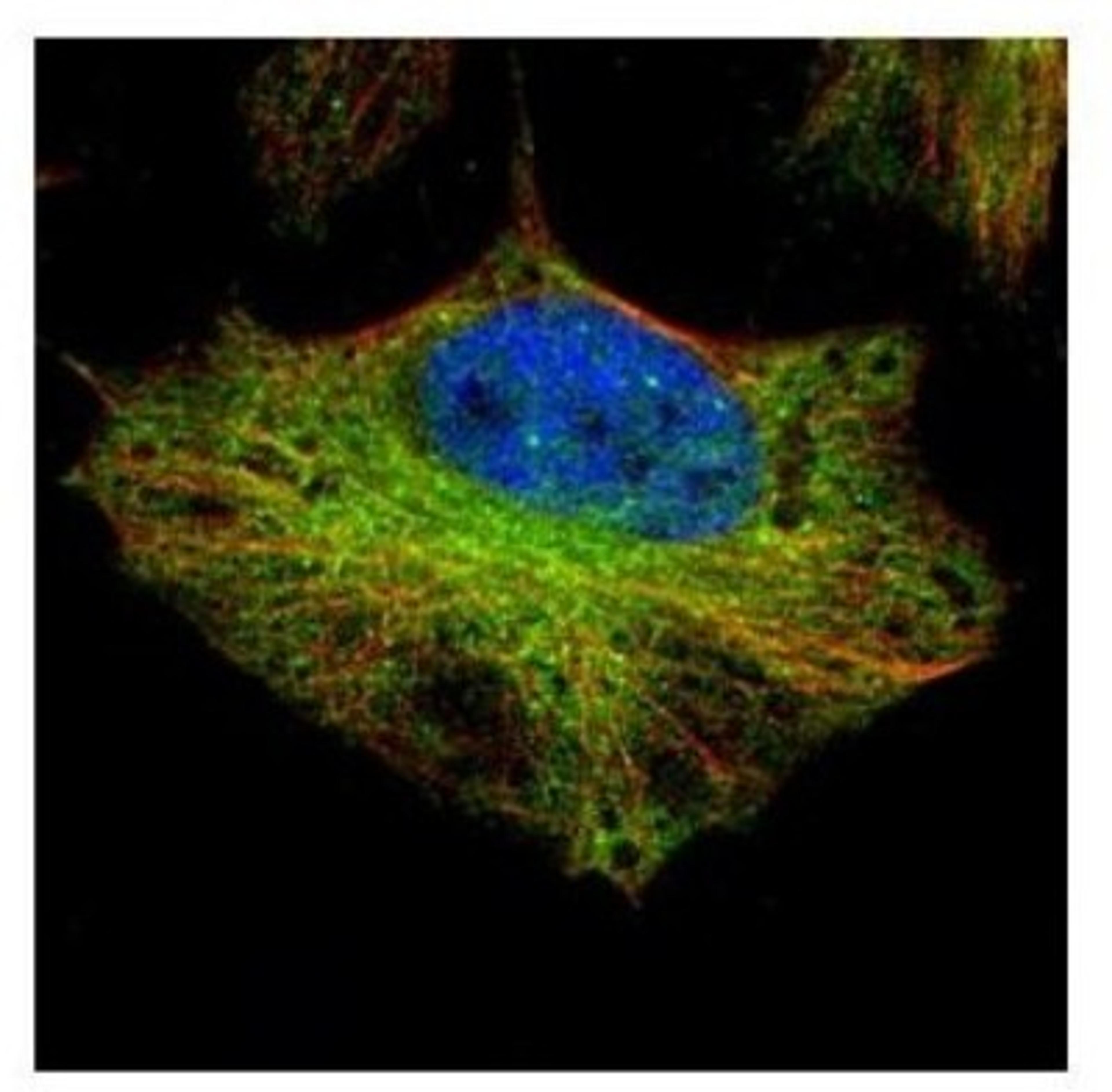 Immunocytochemistry/Immunofluorescence: ELP2 Antibody [NBP2-16321] - Confocal immunofluorescence analysis of paraformaldehyde-fixed HeLa, using ELP2 antibody (Green) at 1:500 dilution. Alpha-tubulin filaments are labeled with Alpha-tubulin antibody (Red) at 1:2000.