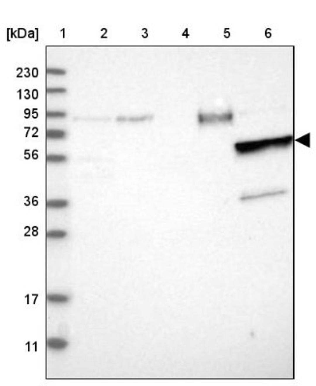 Western Blot: MMP8 Antibody [NBP1-85576] - Lane 1: Marker [kDa] 230, 130, 95, 72, 56, 36, 28, 17, 11<br/>Lane 2: Human cell line RT-4<br/>Lane 3: Human cell line U-251MG sp<br/>Lane 4: Human plasma (IgG/HSA depleted)<br/>Lane 5: Human liver tissue<br/>Lane 6: Human tonsil tissue