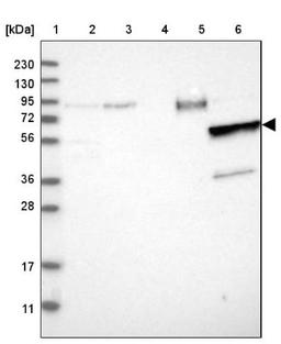 Western Blot: MMP8 Antibody [NBP1-85576] - Lane 1: Marker [kDa] 230, 130, 95, 72, 56, 36, 28, 17, 11<br/>Lane 2: Human cell line RT-4<br/>Lane 3: Human cell line U-251MG sp<br/>Lane 4: Human plasma (IgG/HSA depleted)<br/>Lane 5: Human liver tissue<br/>Lane 6: Human tonsil tissue