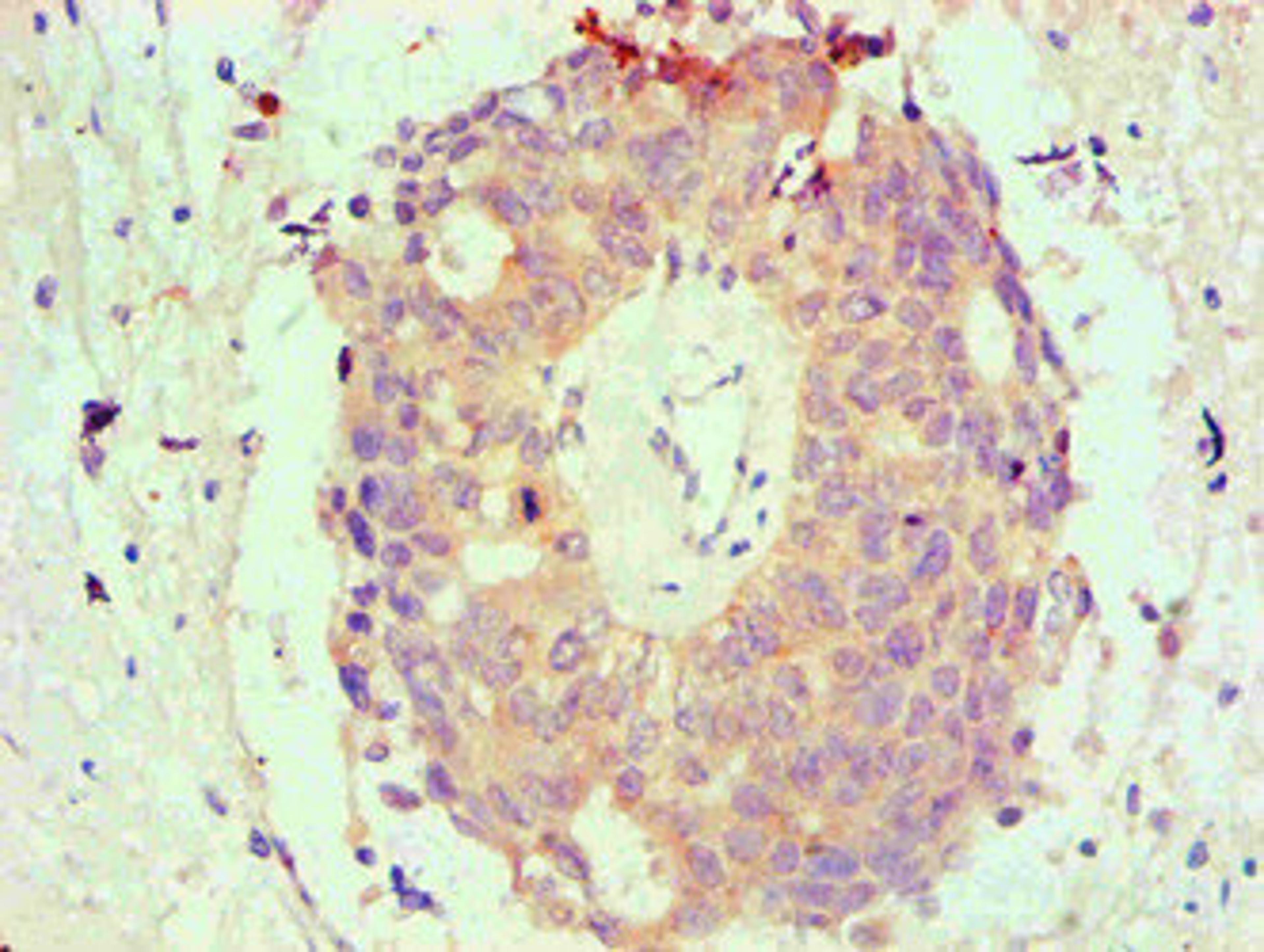 Immunohistochemical of paraffin-embedded Human endometrium tissue using CSB-MA0026131A0m at dilution of 1:200