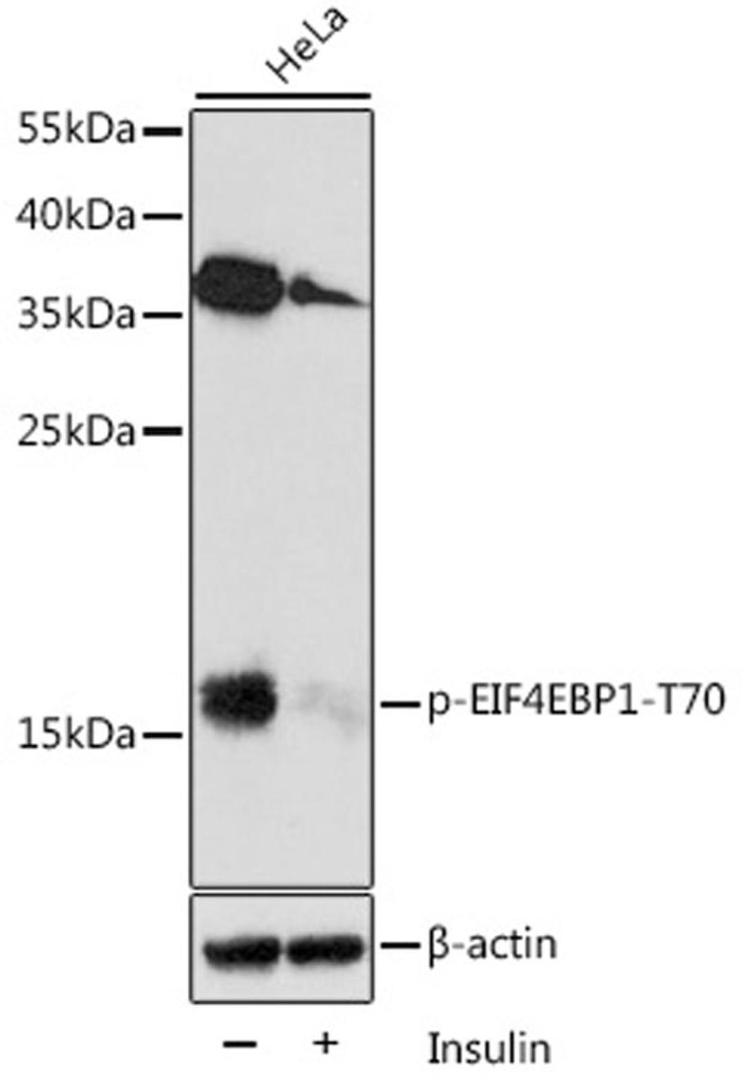 Western blot - Phospho-EIF4EBP1-T70 antibody (AP0031)