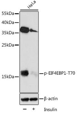 Western blot - Phospho-EIF4EBP1-T70 antibody (AP0031)