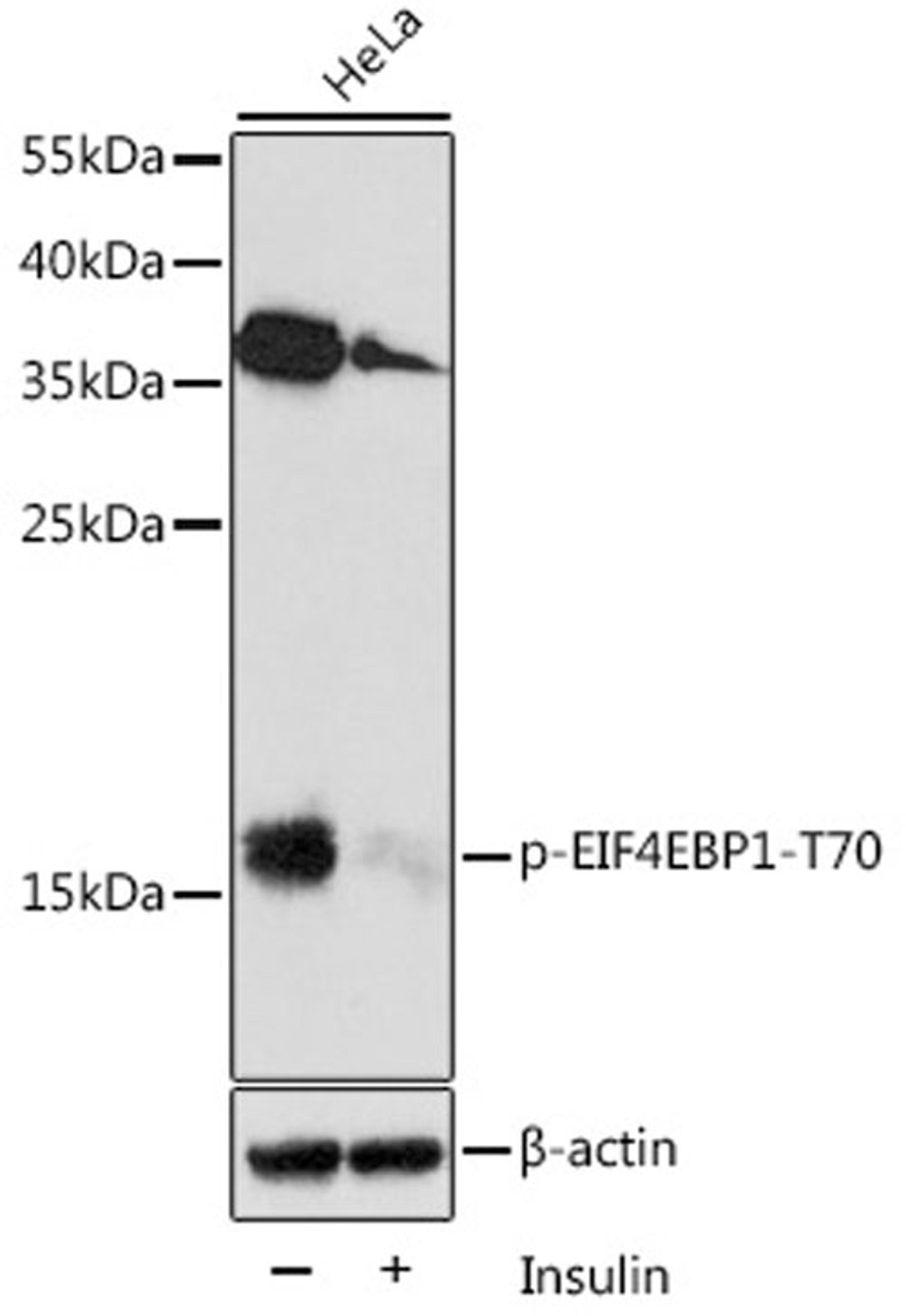 Western blot - Phospho-EIF4EBP1-T70 antibody (AP0031)