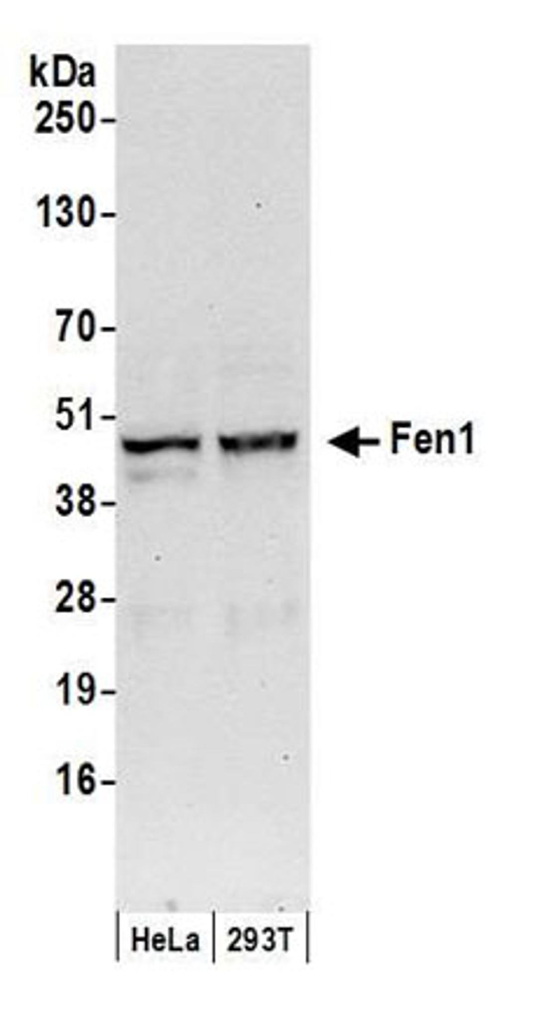 Detection of human Fen1 by western blot.