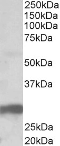 46-589 (0.5ug/ml) staining of Human Pancreas lysate (35ug protein in RIPA buffer). Primary incubation was 1 hour. Detected by chemiluminescence.