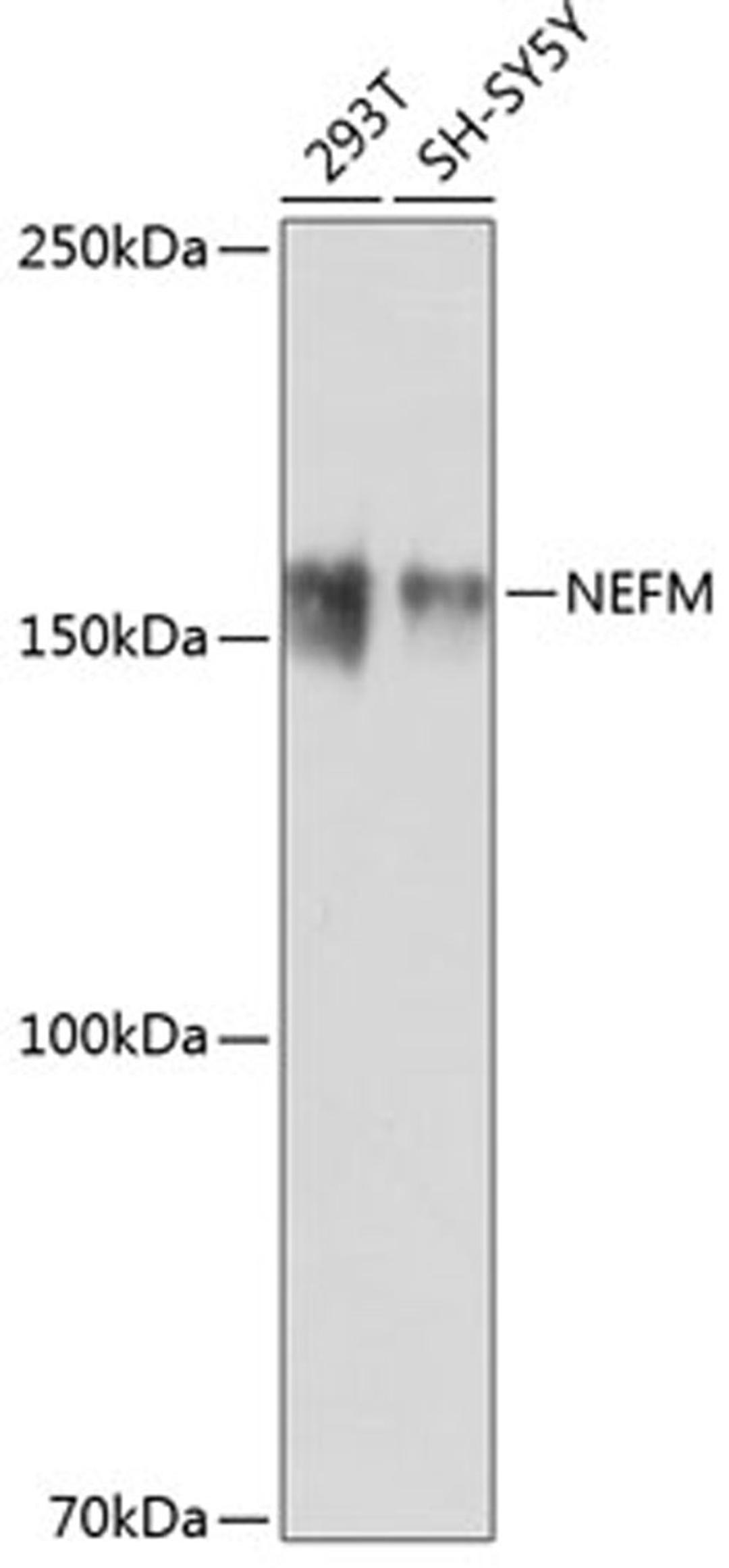 Western blot - NEFM antibody (A19085)