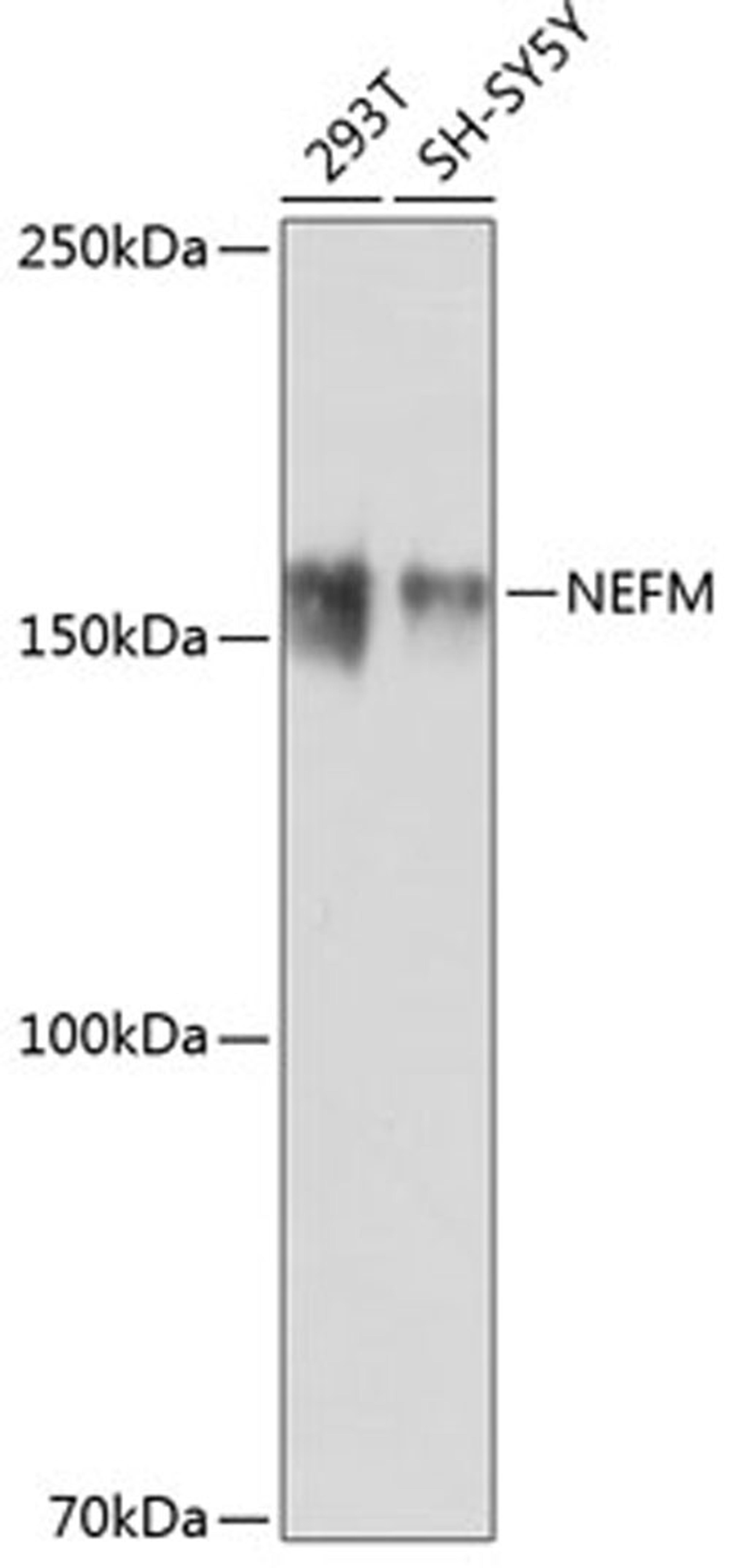 Western blot - NEFM antibody (A19085)