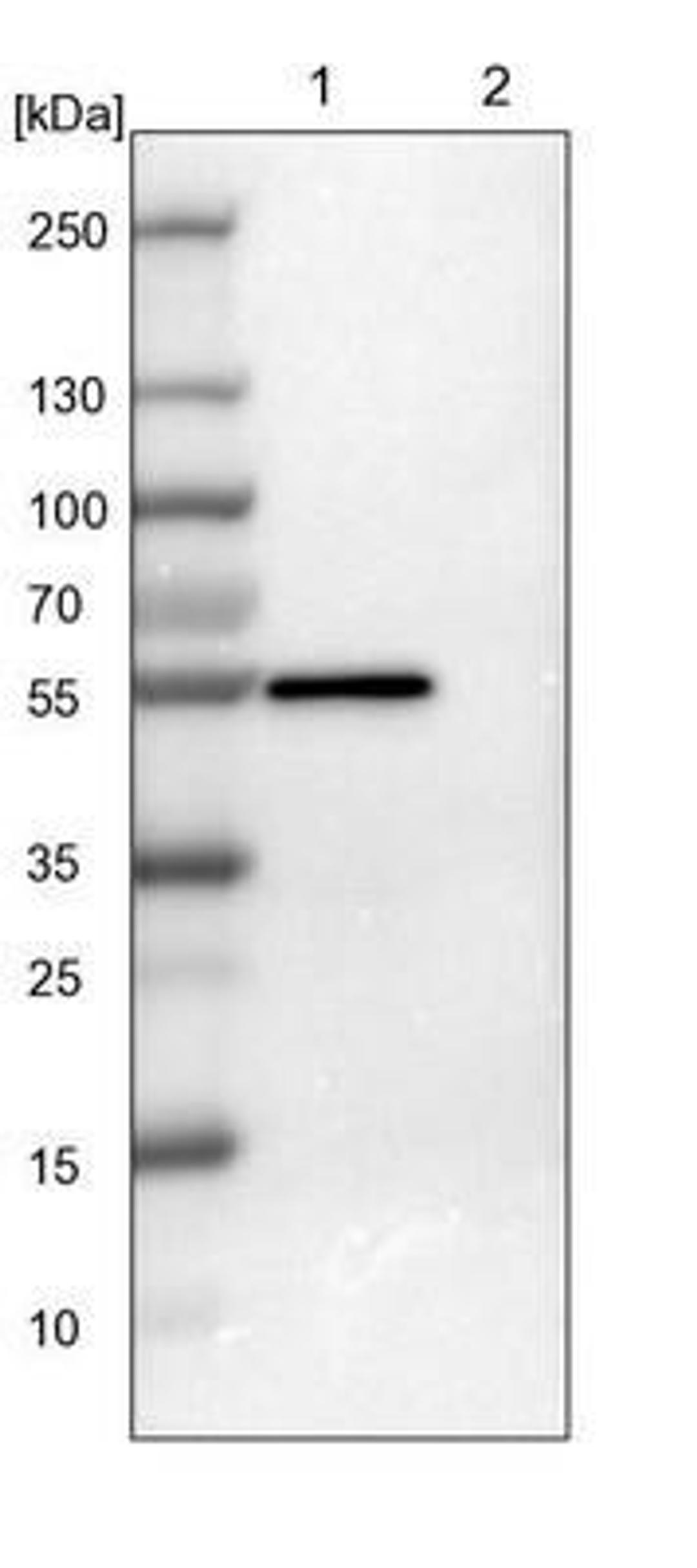 Western Blot: FoxJ1/HFH4 Antibody [NBP1-87928] - HFH4 Antibody [NBP1-87928] - Lane 1: NIH-3T3 cell lysate (Mouse embryonic fibroblast cells), Lane 2: NBT-II cell lysate (Rat Wistar bladder tumour cells).