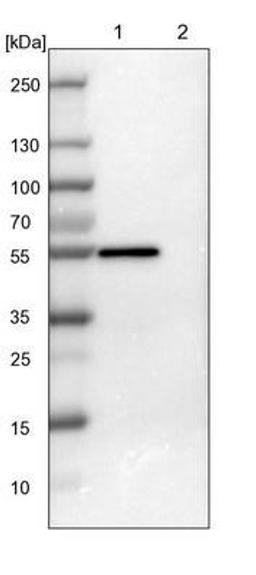 Western Blot: FoxJ1/HFH4 Antibody [NBP1-87928] - HFH4 Antibody [NBP1-87928] - Lane 1: NIH-3T3 cell lysate (Mouse embryonic fibroblast cells), Lane 2: NBT-II cell lysate (Rat Wistar bladder tumour cells).