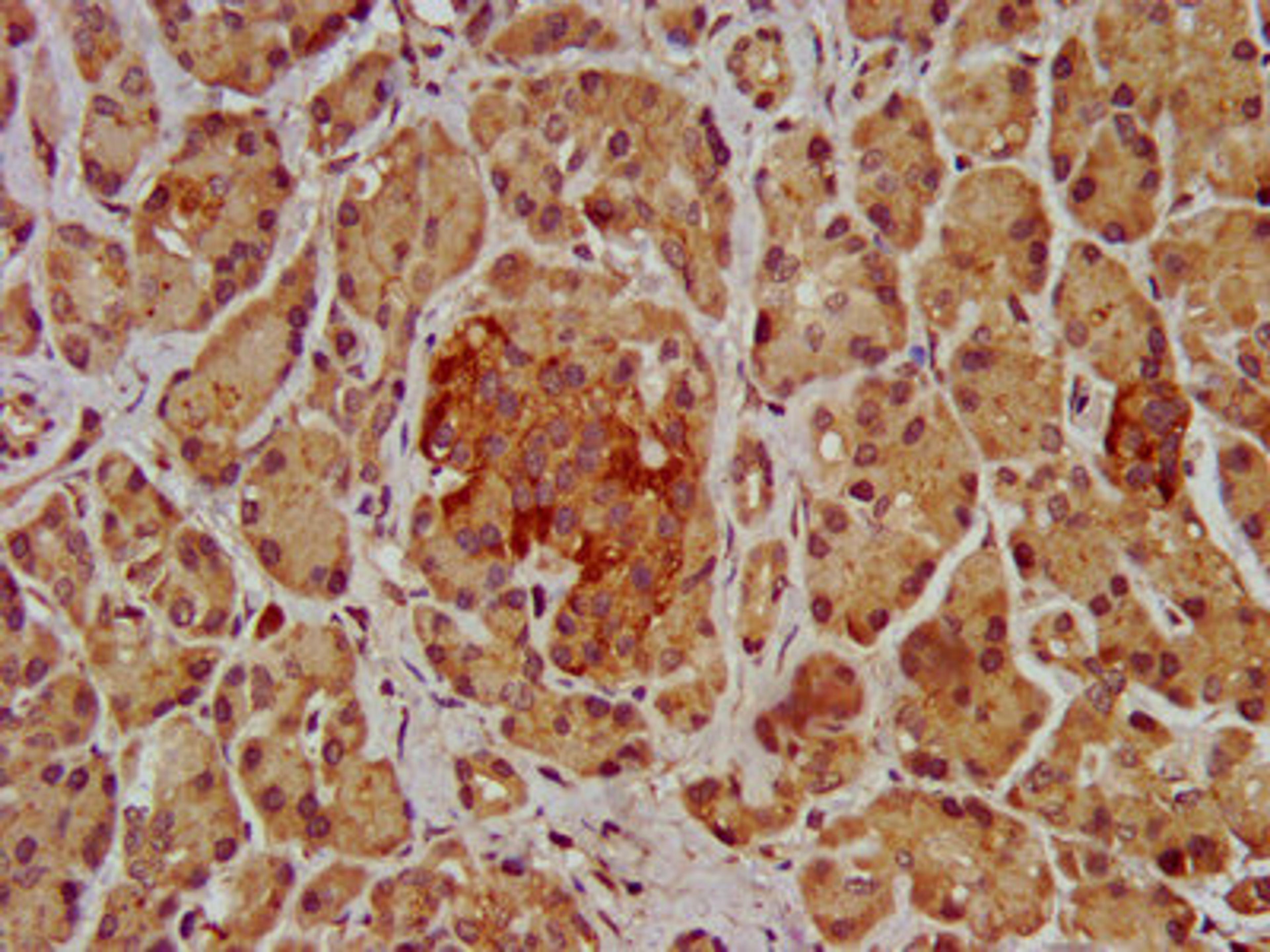 IHC image of CSB-PA622684LA01HU diluted at 1:200 and staining in paraffin-embedded human pancreatic tissue performed on a Leica BondTM system. After dewaxing and hydration, antigen retrieval was mediated by high pressure in a citrate buffer (pH 6.0). Section was blocked with 10% normal goat serum 30min at RT. Then primary antibody (1% BSA) was incubated at 4&deg;C overnight. The primary is detected by a biotinylated secondary antibody and visualized using an HRP conjugated SP system.