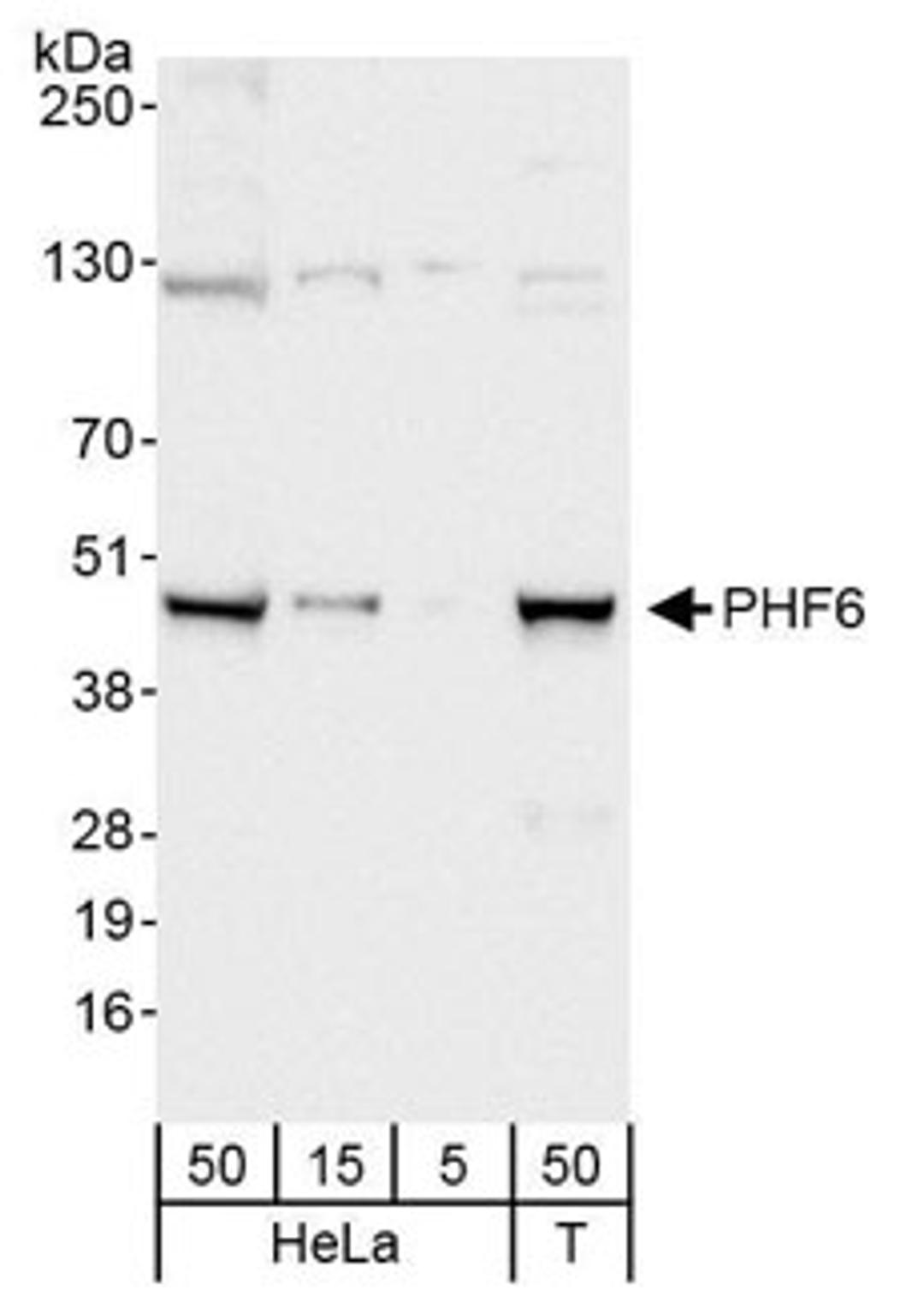 Detection of human PHF6 by western blot.