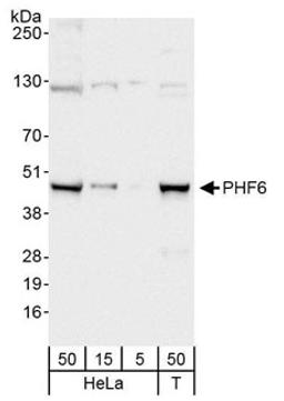 Detection of human PHF6 by western blot.