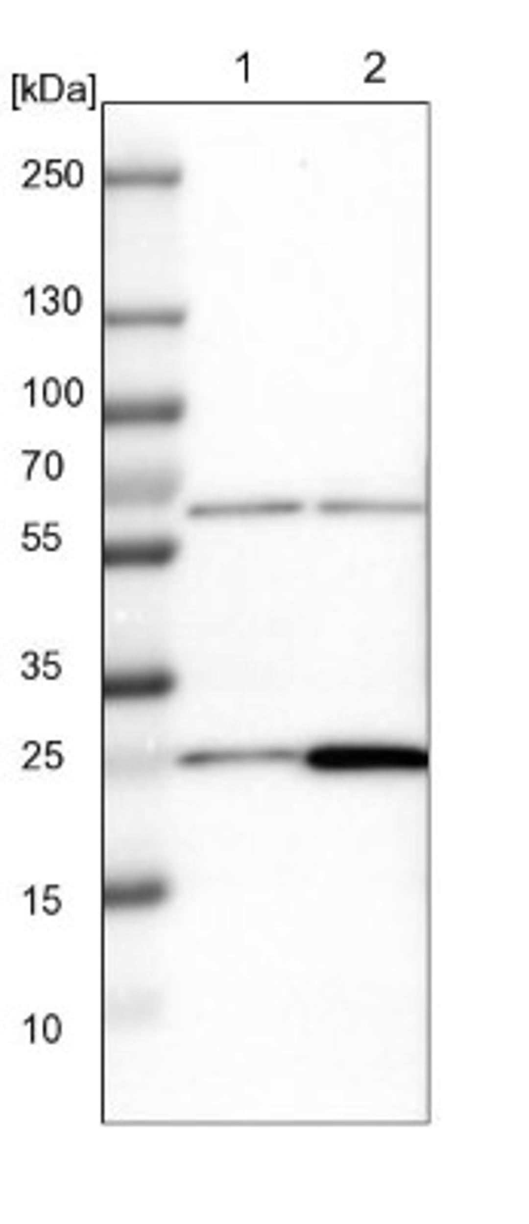 Western Blot: MRPS7 Antibody [NBP1-81029] - Lane 1: NIH-3T3 cell lysate (Mouse embryonic fibroblast cells)<br/>Lane 2: NBT-II cell lysate (Rat Wistar bladder tumour cells)