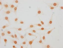 Immunocytochemistry analysis of CSB-PA010380OA25me1HU diluted at 1:20 and staining in Hela cells performed on a Leica BondTM system. The cells were fixed in 4% formaldehyde, permeabilized using 0.2% Triton X-100 and blocked with 10% normal goat serum 30min at RT. Then primary antibody (1% BSA) was incubated at 4°C overnight. The primary is detected by a biotinylated secondary antibody and visualized using an HRP conjugated SP system.