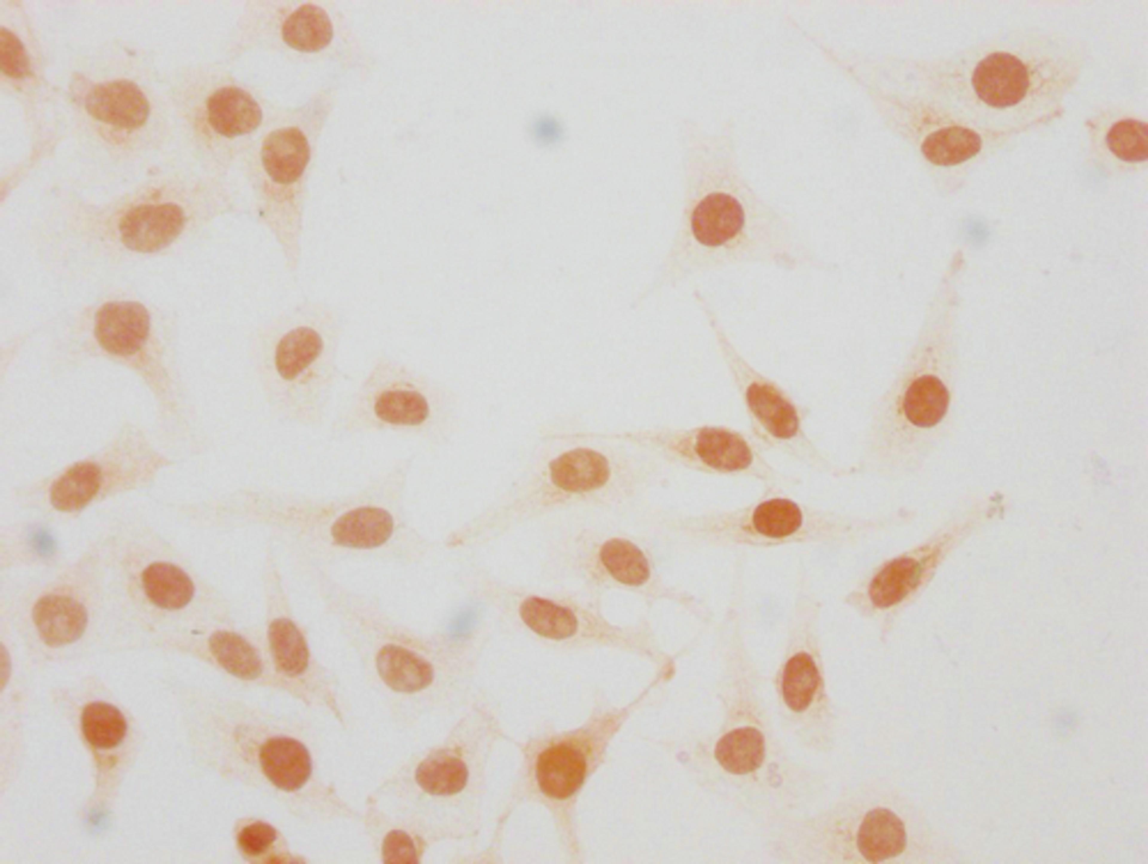 Immunocytochemistry analysis of CSB-PA010380OA25me1HU diluted at 1:20 and staining in Hela cells performed on a Leica BondTM system. The cells were fixed in 4% formaldehyde, permeabilized using 0.2% Triton X-100 and blocked with 10% normal goat serum 30min at RT. Then primary antibody (1% BSA) was incubated at 4°C overnight. The primary is detected by a biotinylated secondary antibody and visualized using an HRP conjugated SP system.