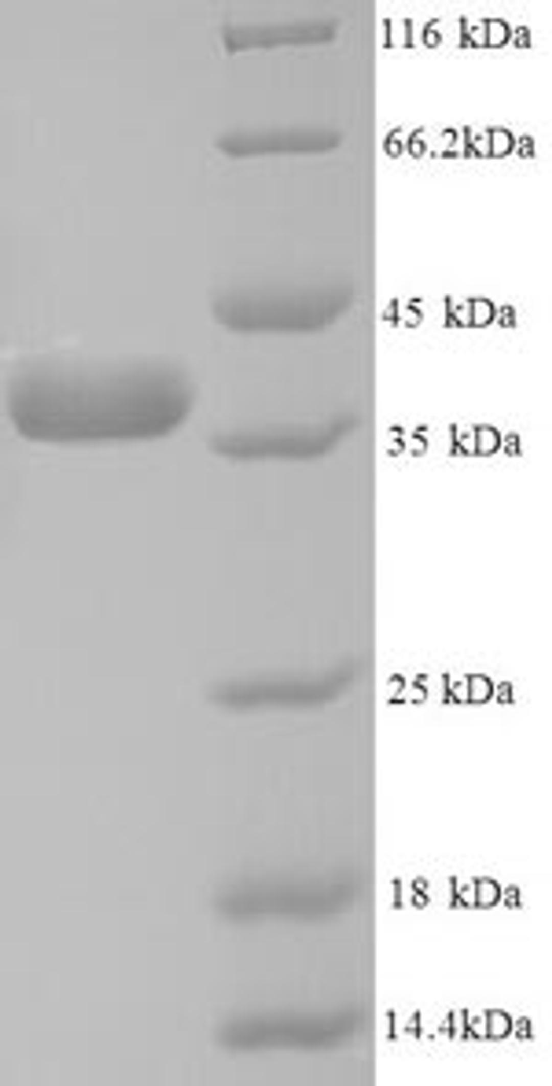 (Tris-Glycine gel) Discontinuous SDS-PAGE (reduced) with 5% enrichment gel and 15% separation gel.