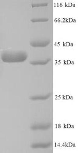 (Tris-Glycine gel) Discontinuous SDS-PAGE (reduced) with 5% enrichment gel and 15% separation gel.