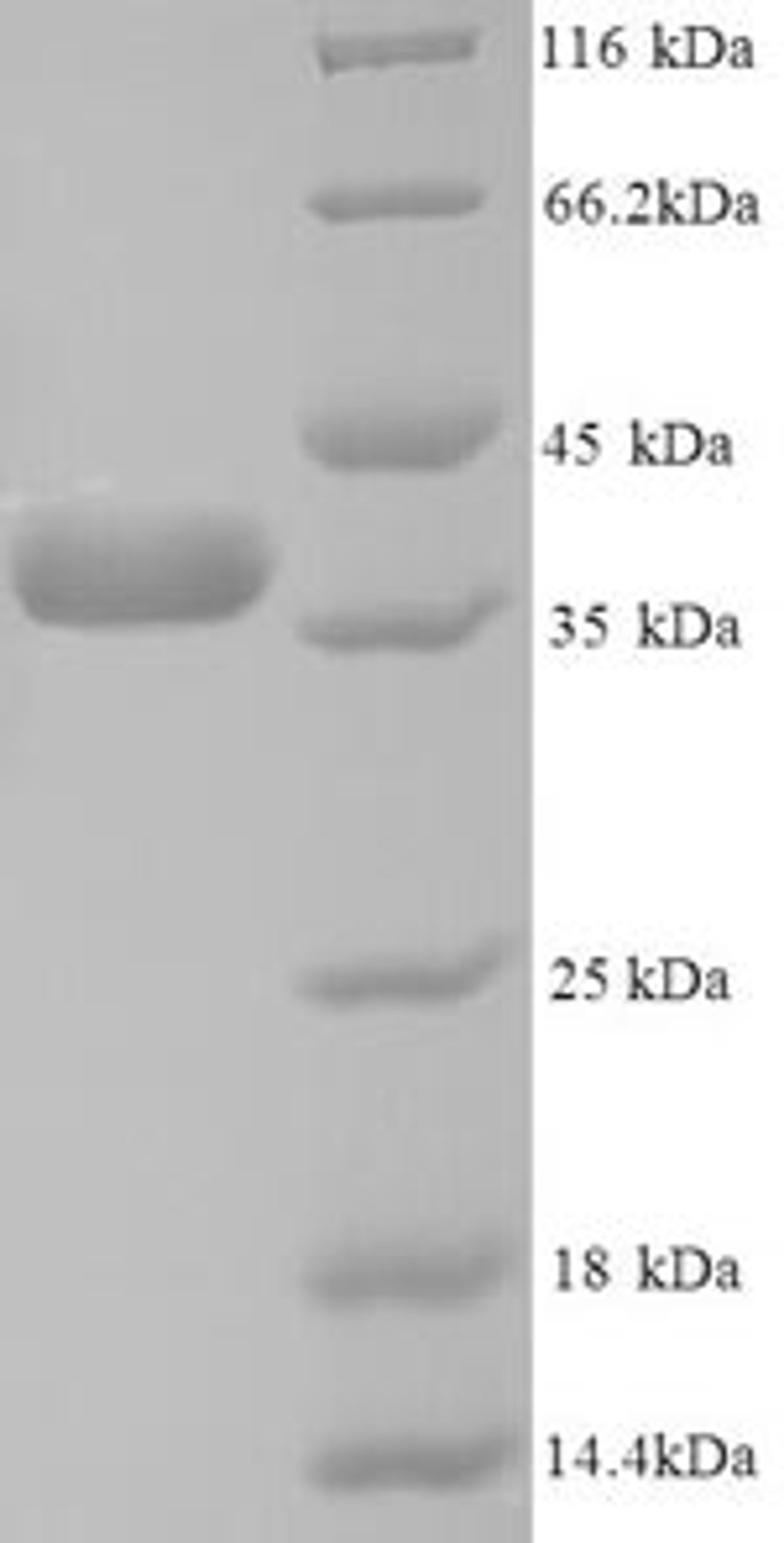 (Tris-Glycine gel) Discontinuous SDS-PAGE (reduced) with 5% enrichment gel and 15% separation gel.