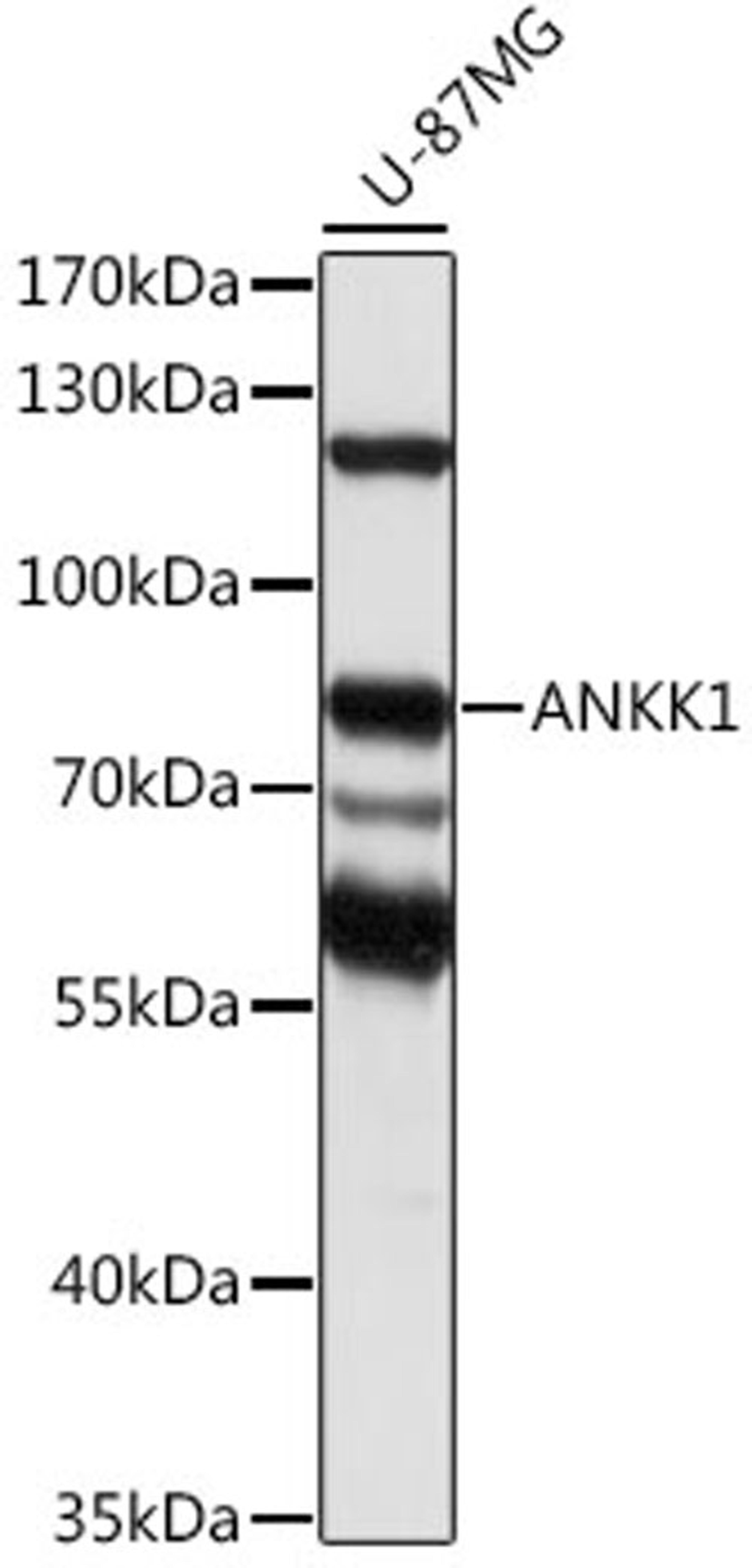 Western blot - ANKK1 antibody (A16178)