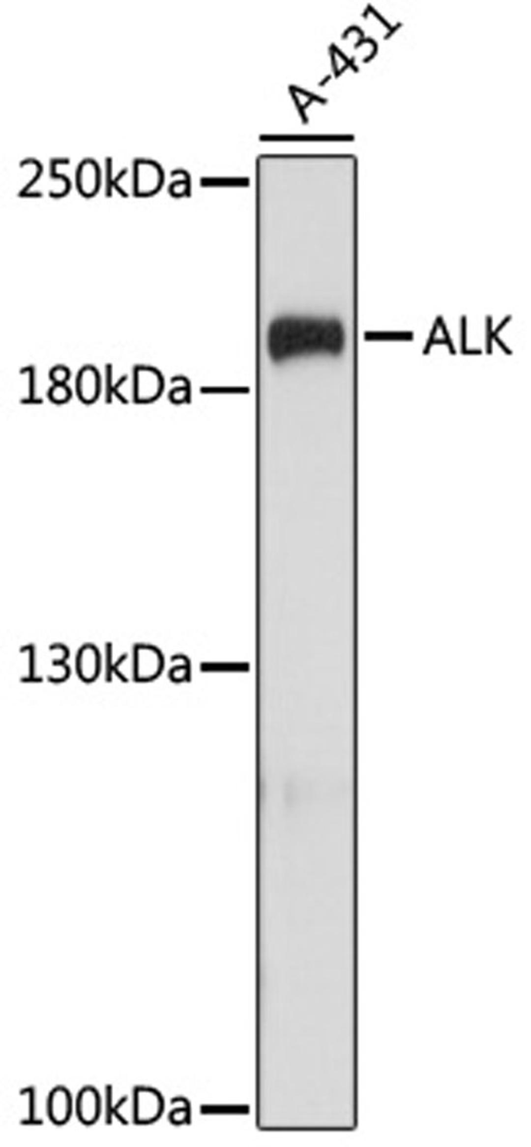 Western blot - ALK antibody (A0766)