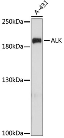 Western blot - ALK antibody (A0766)