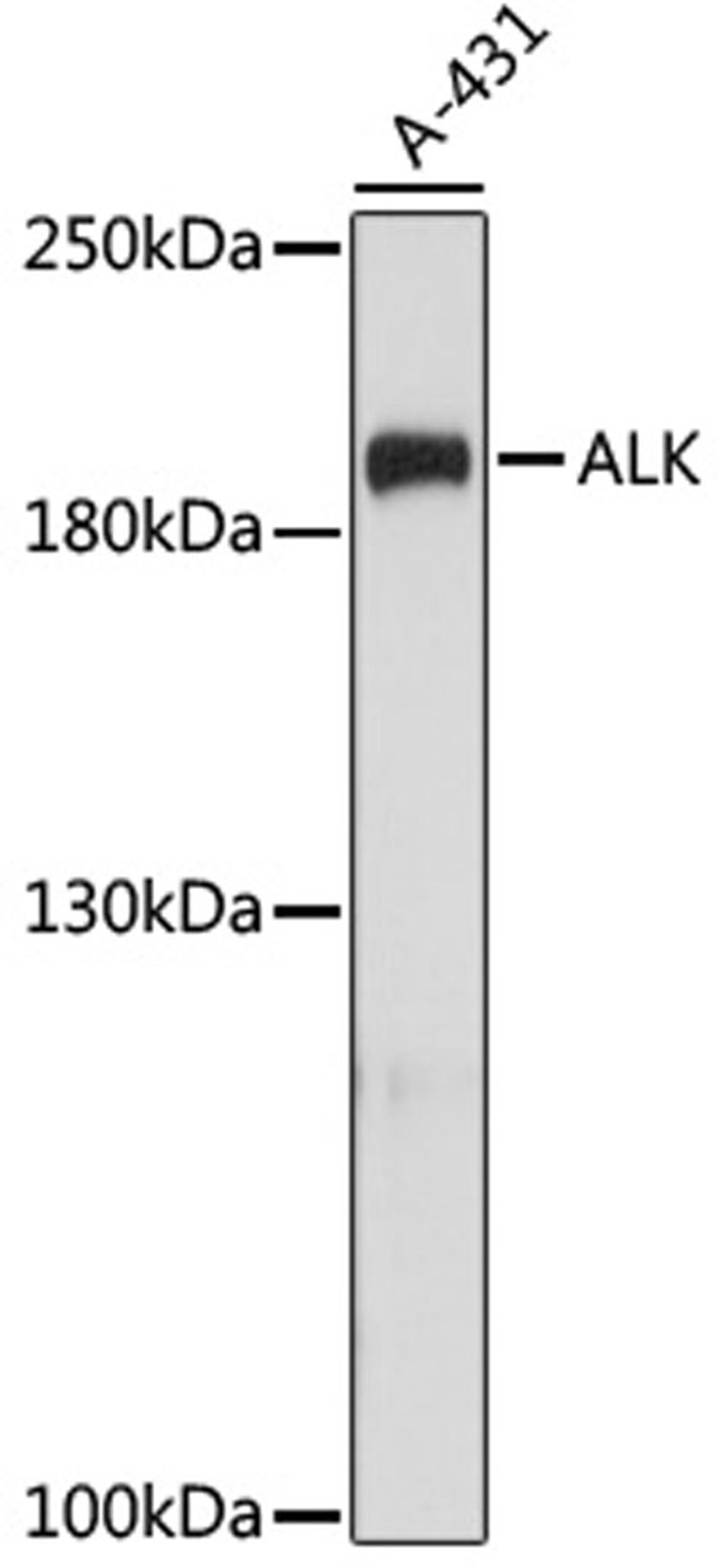 Western blot - ALK antibody (A0766)