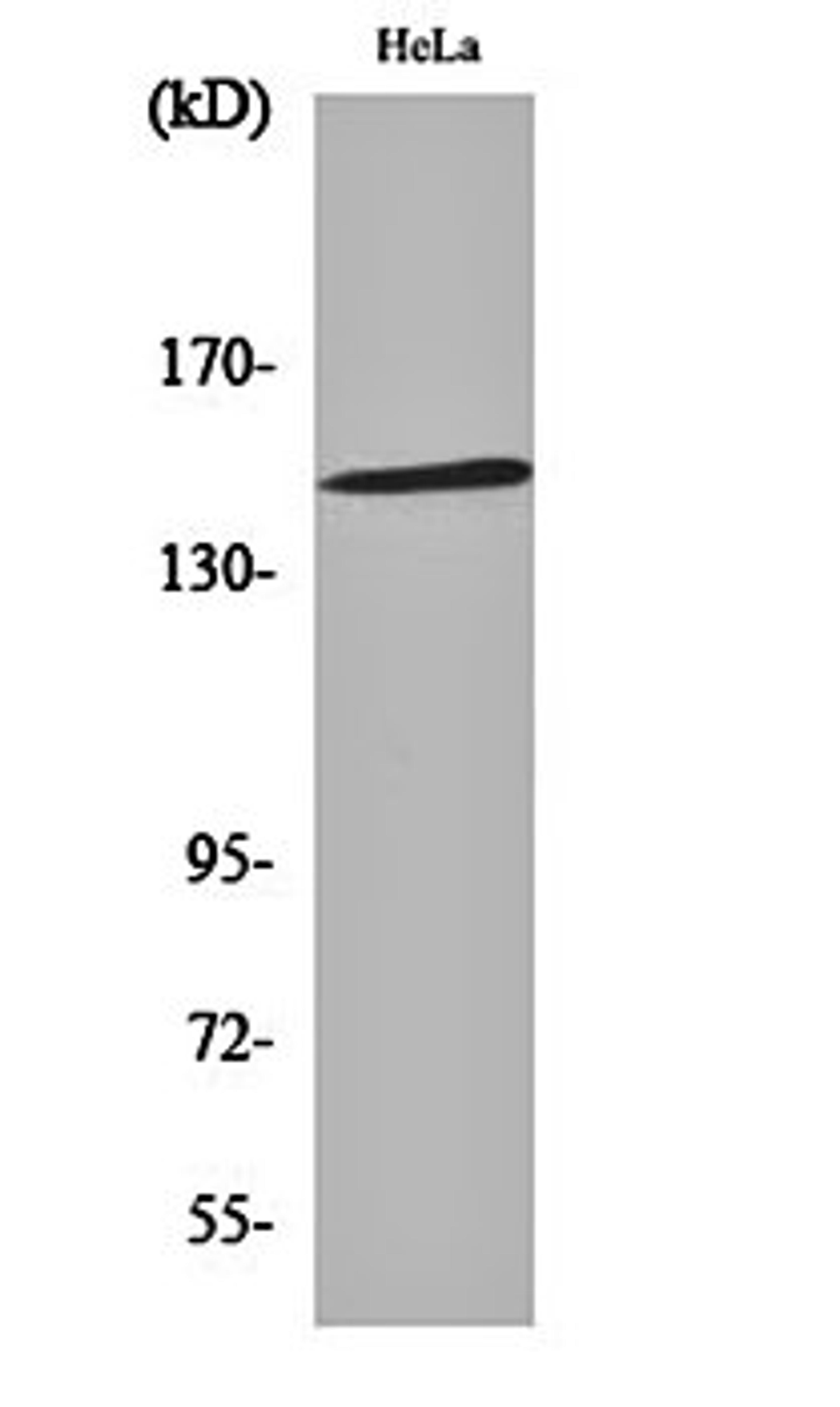 Western blot analysis of Hela cell lysates using JIP-3 antibody