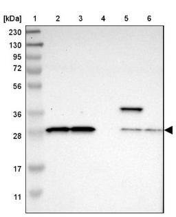 Western Blot: ACMSD Antibody [NBP1-86108] - Lane 1: Marker [kDa] 230, 130, 95, 72, 56, 36, 28, 17, 11<br/>Lane 2: Human cell line RT-4<br/>Lane 3: Human cell line U-251MG sp<br/>Lane 4: Human plasma (IgG/HSA depleted)<br/>Lane 5: Human liver tissue<br/>Lane 6: Human tonsil tissue